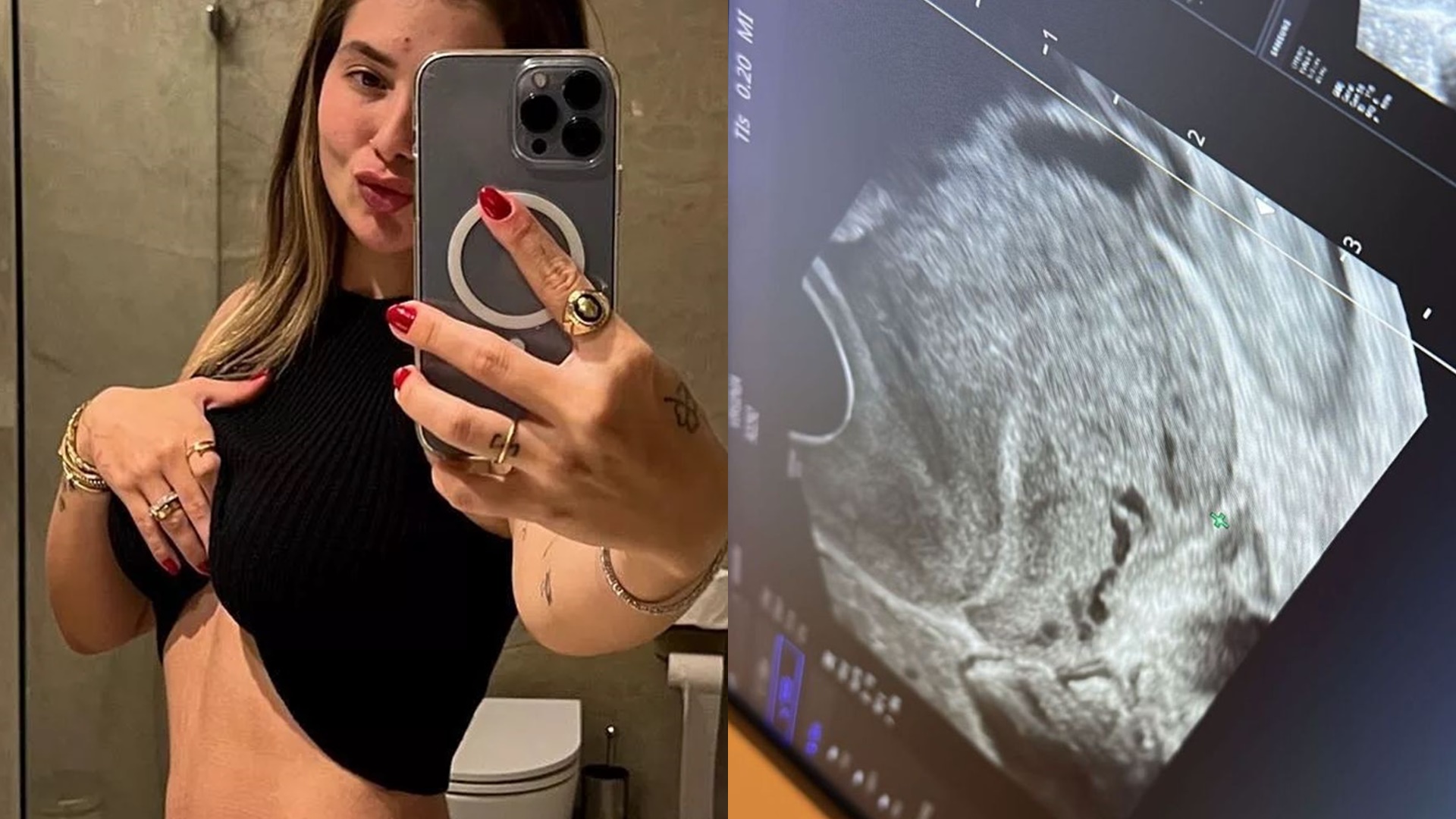 Virginia Fonseca faz novo ultrassom e confirma sobre gravidez: “Tudo certo”