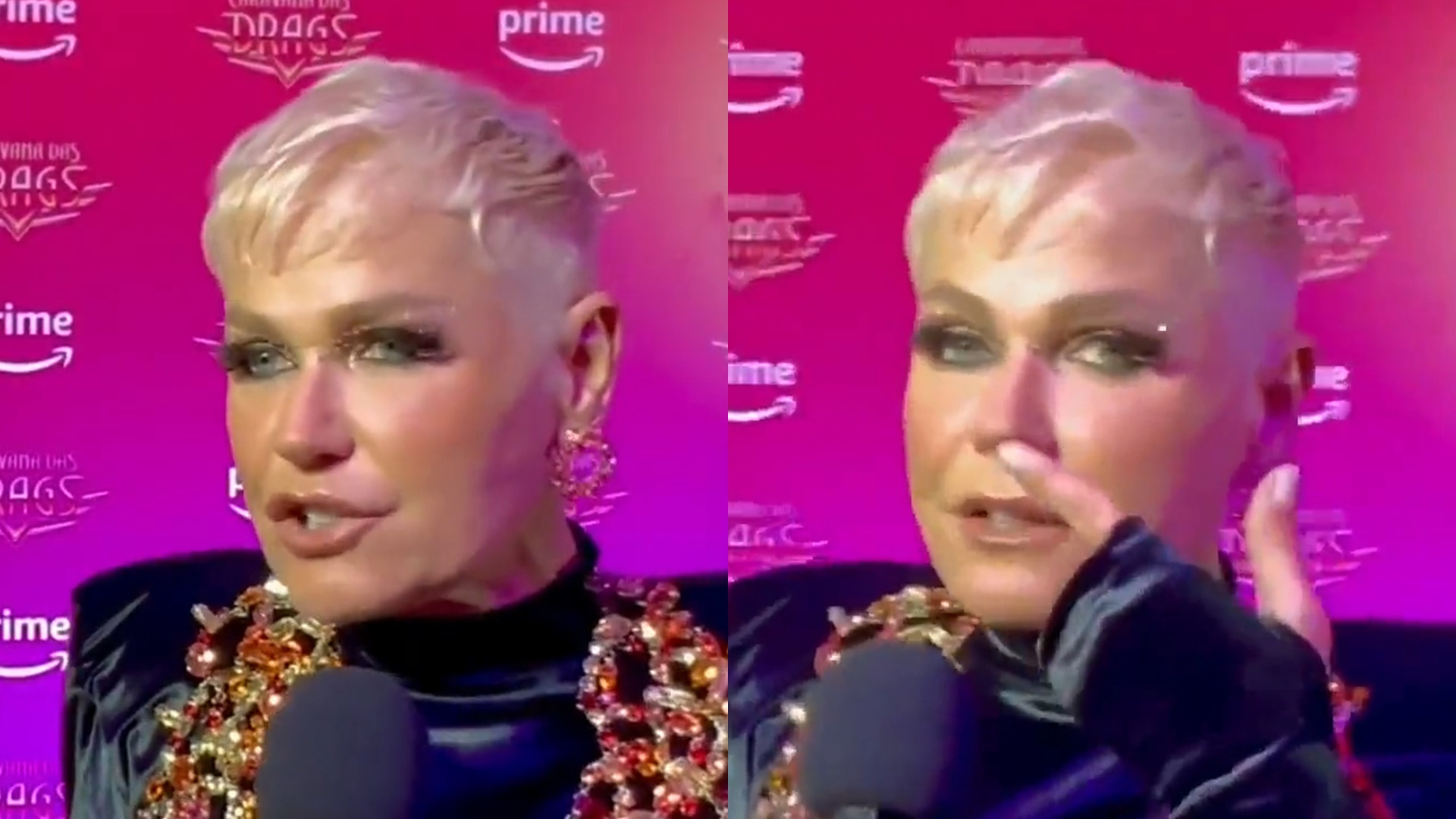 Xuxa Meneghel assume ter escondido polêmica cirurgia no nariz da mãe: “Maior trauma”