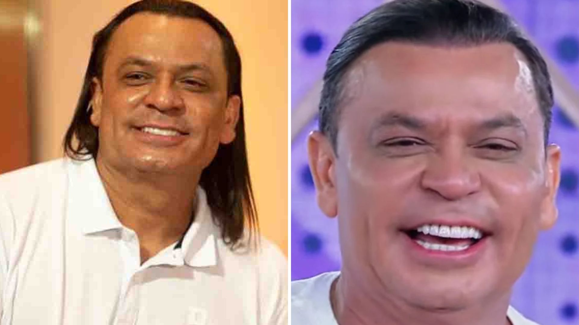 Adeus cabelão! Frank Aguiar radicaliza o visual após harmonização: “Sentimento de desapego”