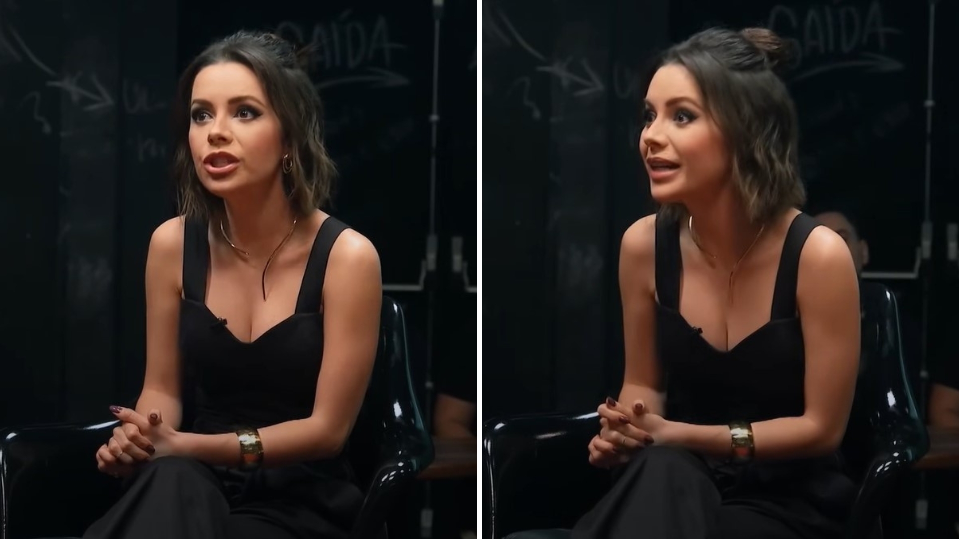 Sandy revela acidente que quase a obrigou a fazer cirurgia plástica: “Dois lugares”