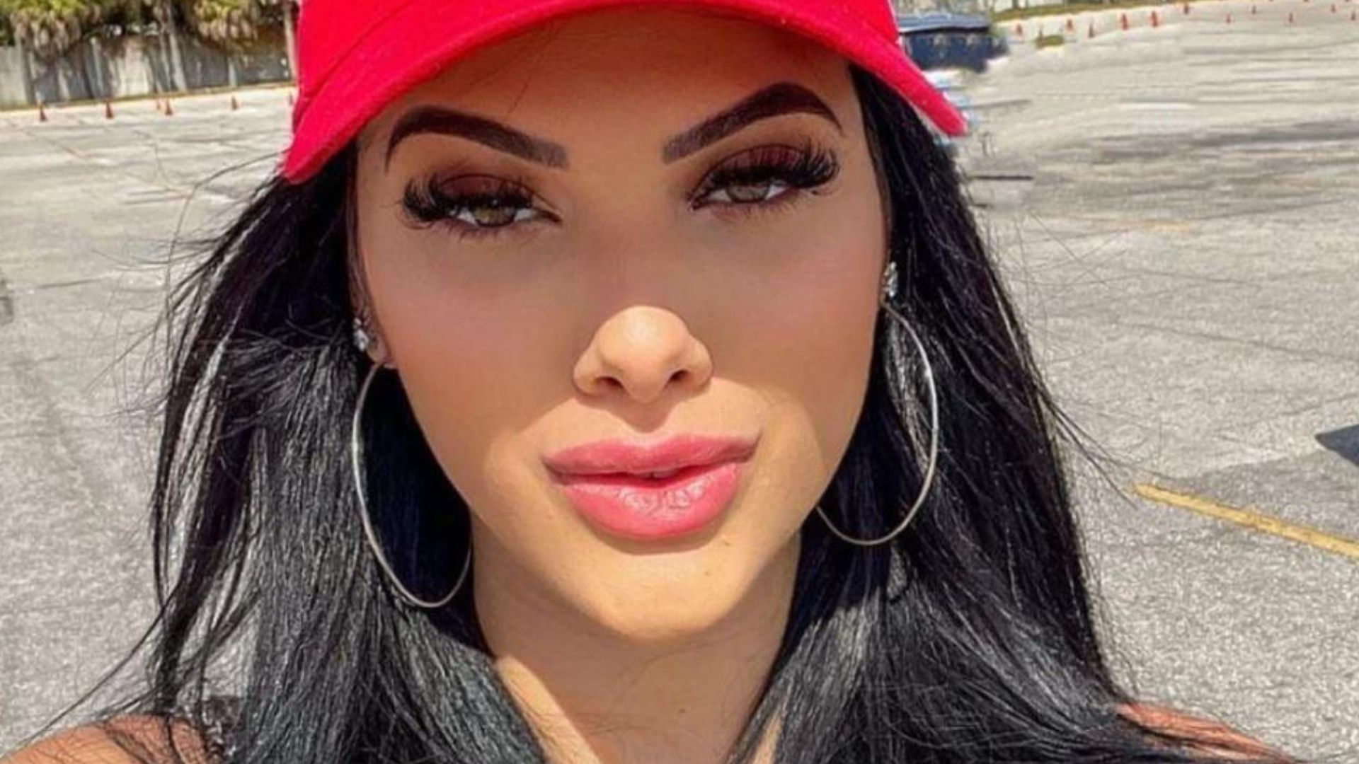Gente? Emily Garcia perde parte da orelha após uso excessivo de brincos: “Arrasada”