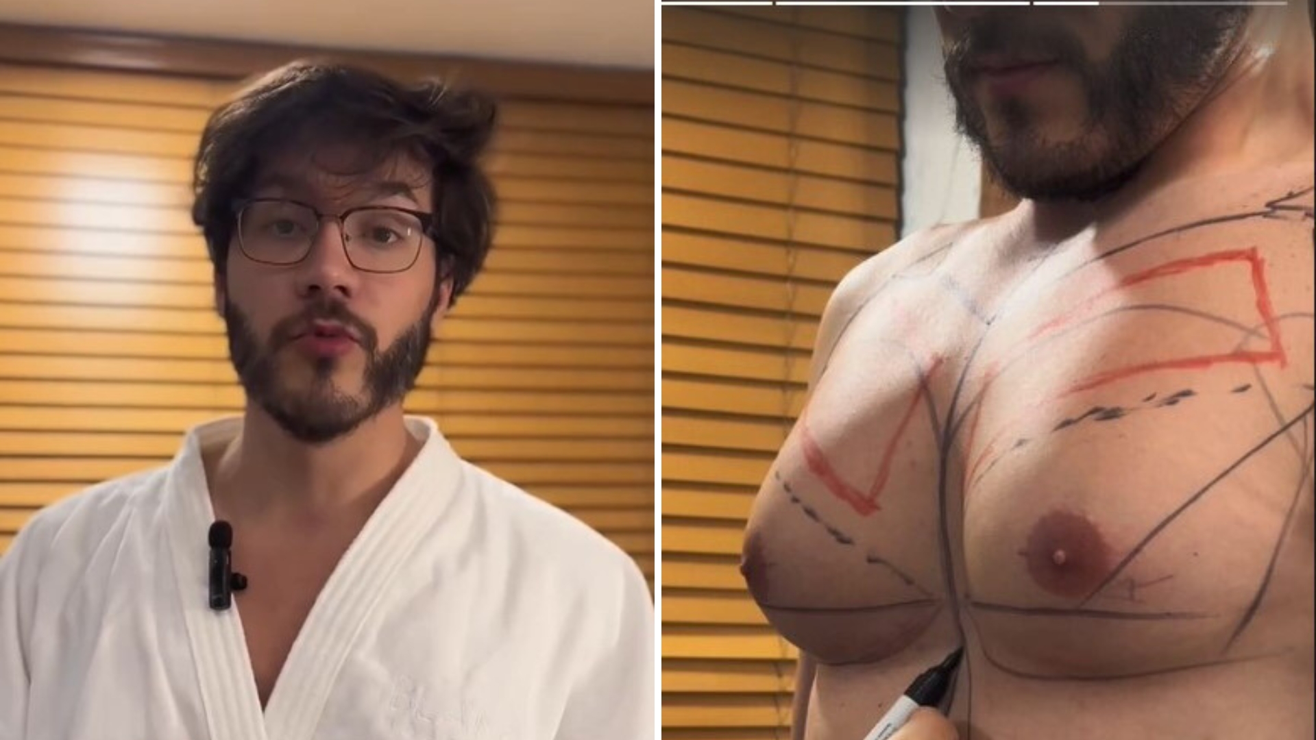 Eliezer realiza cirurgia para redução das mamas e celebra mudança: “Sem meus peitos”
