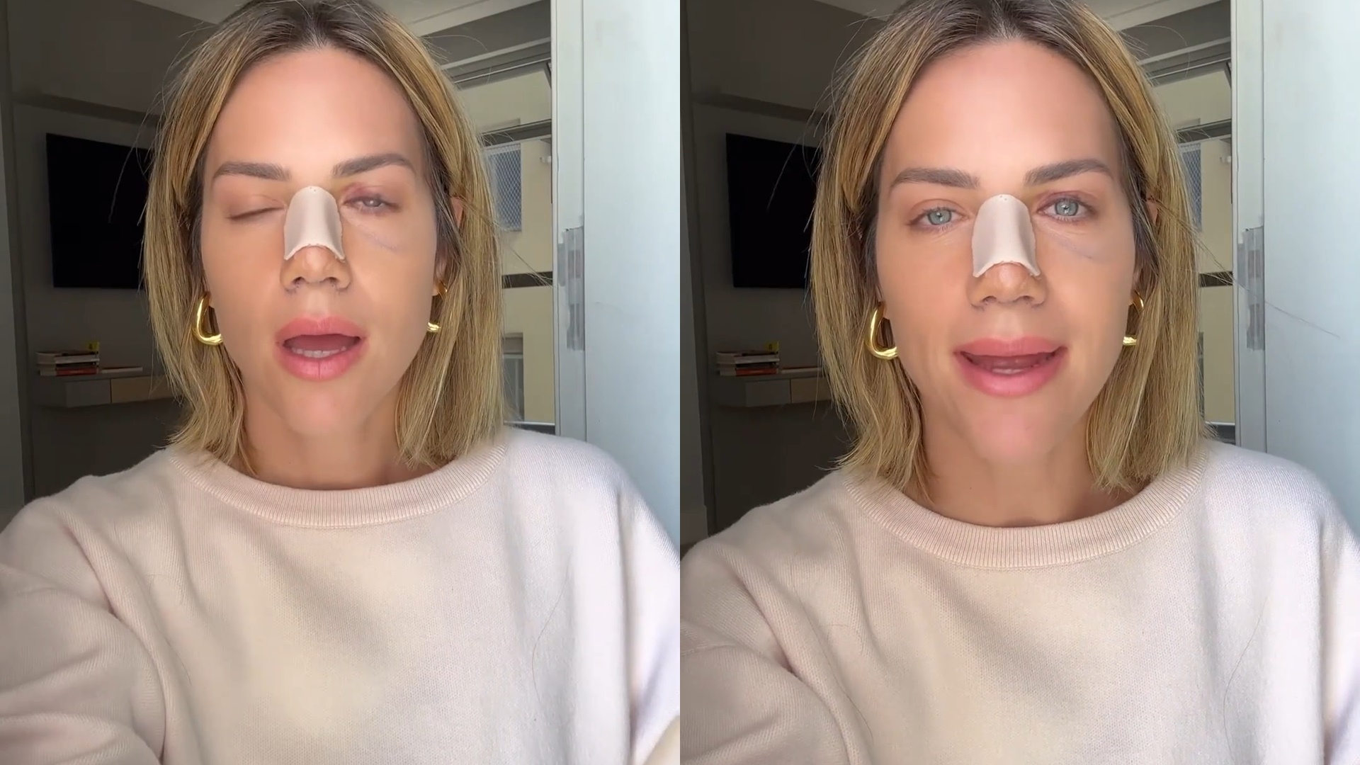 Giovanna Ewbank atualiza estado de saúde após cirurgia no nariz: “Falta de ar”