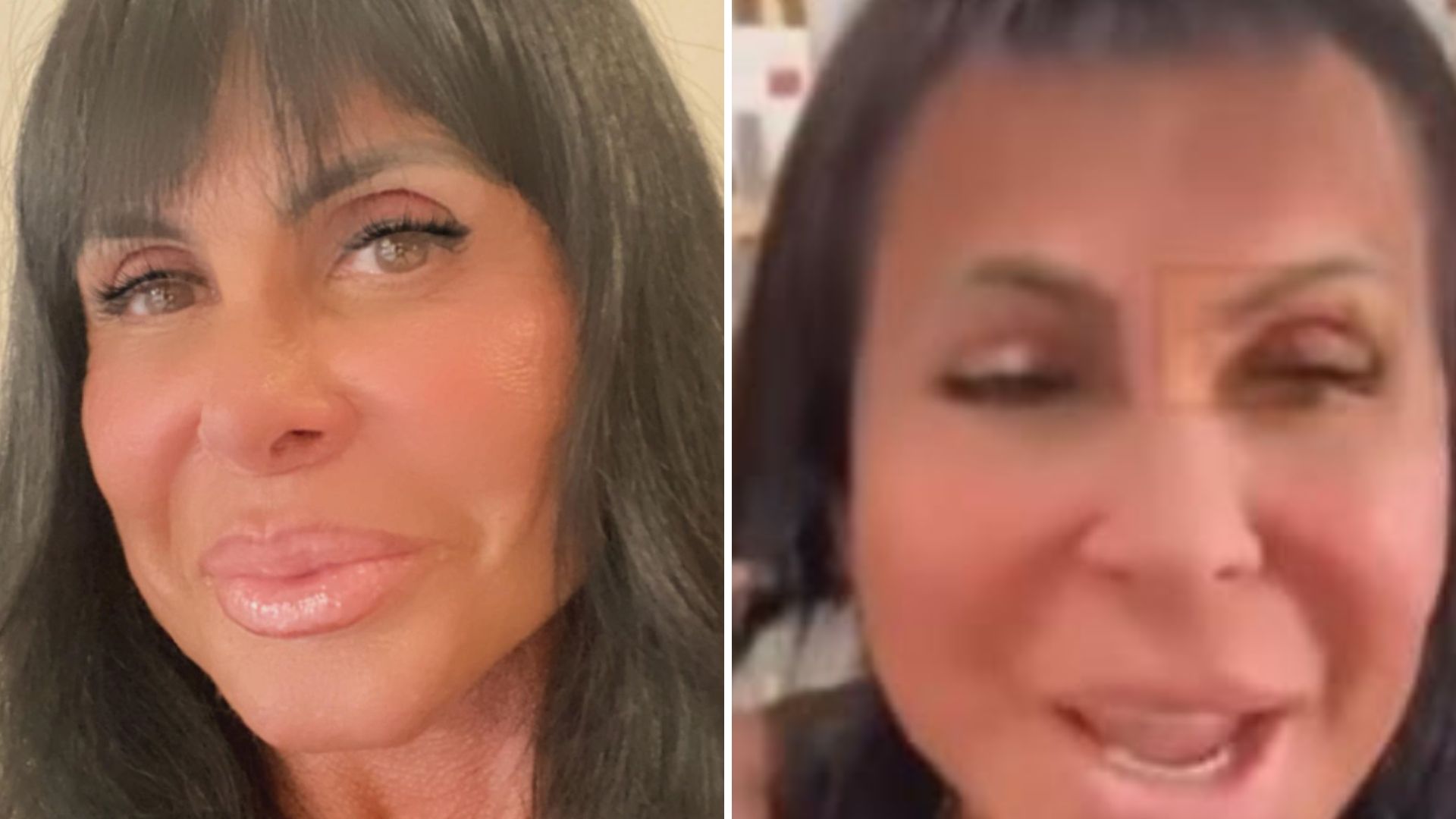 Gretchen retira a peruca, mostra cabelo real e deixa fãs perplexos: “Coitada”
