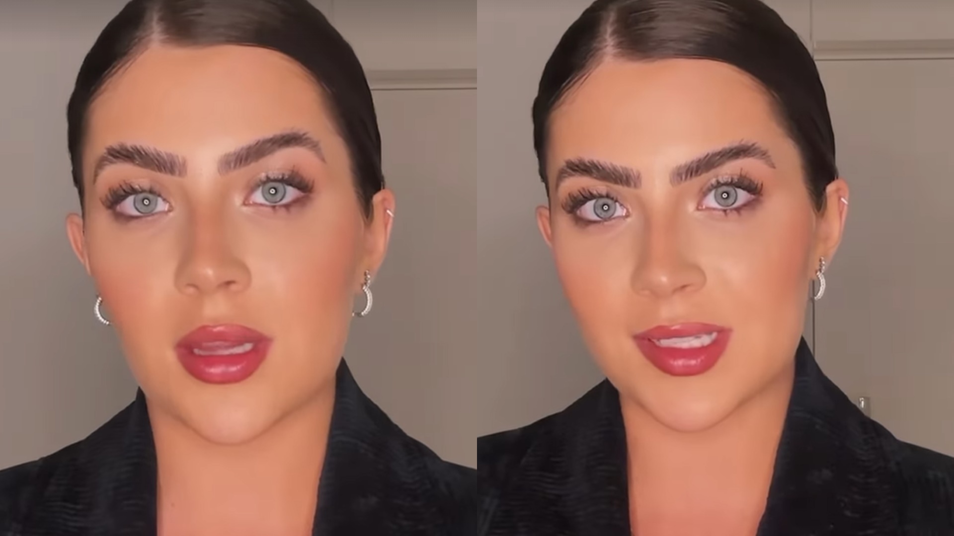 Jade Picon entra em sala de cirurgia para colocar silicone: “Decidi colocar a prótese”