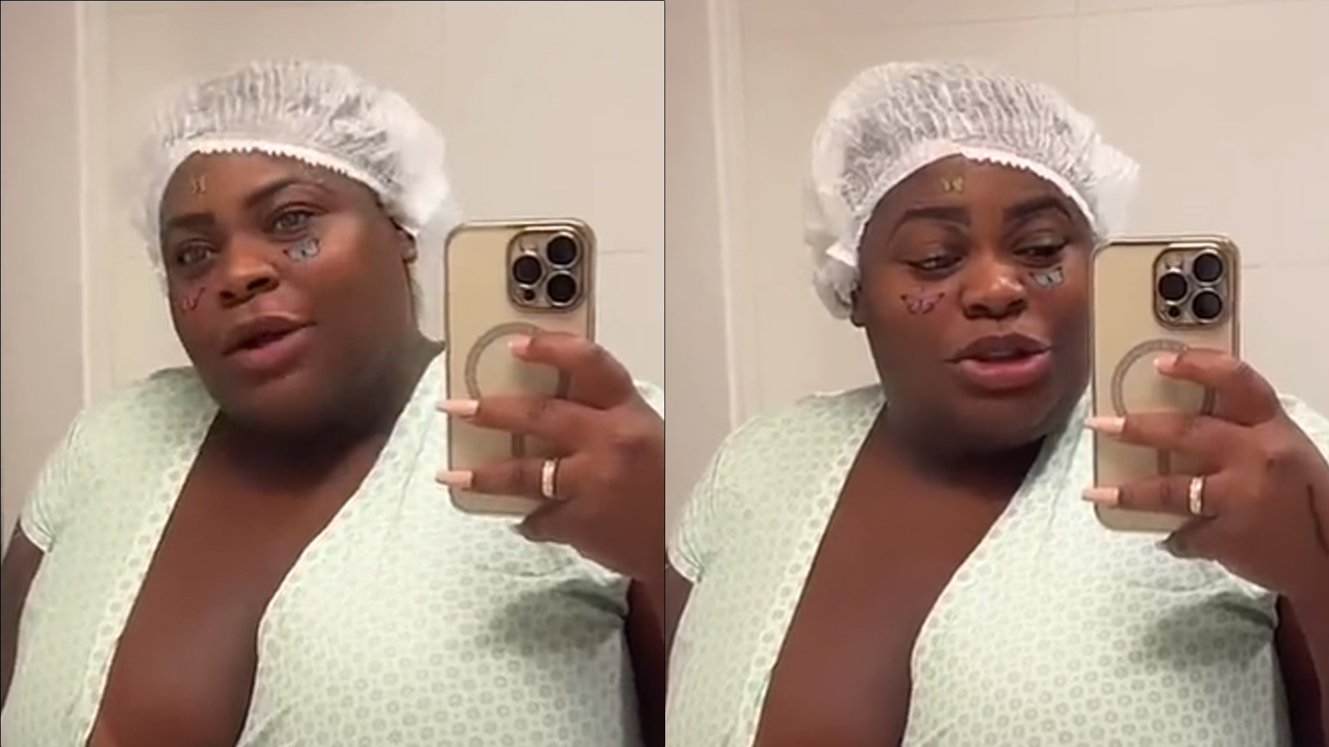 De camisola hospitalar, Jojo Todynho faz última aparição antes da bariátrica: “Estou ótima”