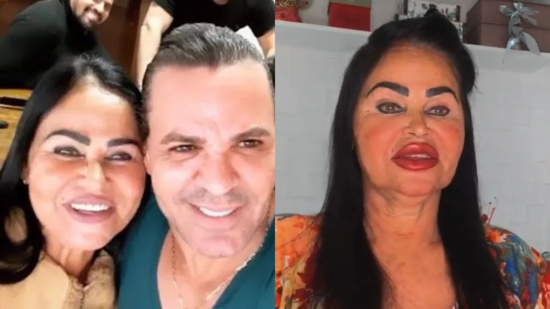 Mãe de Eduardo Costa nega ter feito plásticas após surgir irreconhecível: “Mulher rústica”