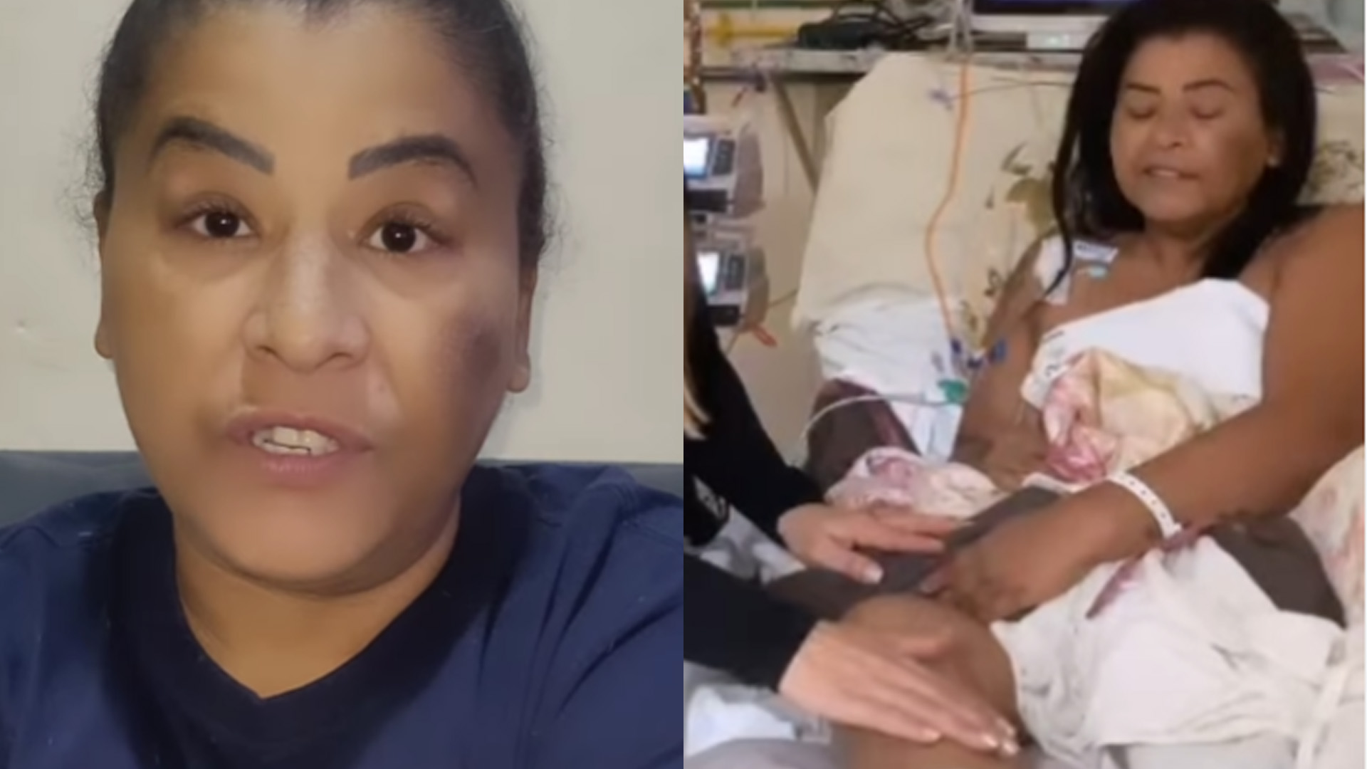 MC Katia perde mais uma parte da perna após complicação em cirurgia: “Forte”