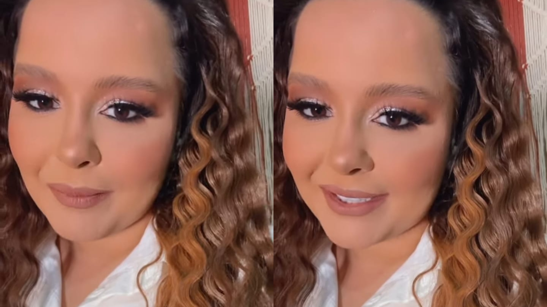 Alopecia: o que é e quais são os sintomas da doença que afeta Maiara?