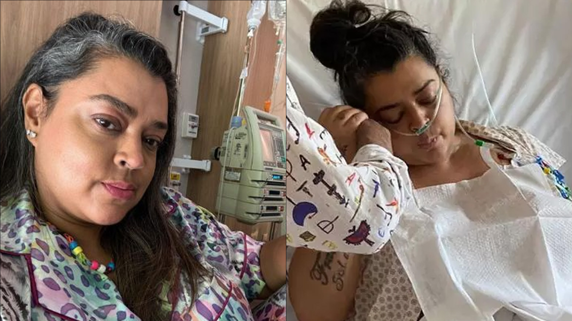 Preta Gil passa por retirada de tumor e novos detalhes são divulgados: “Está reconstituindo”