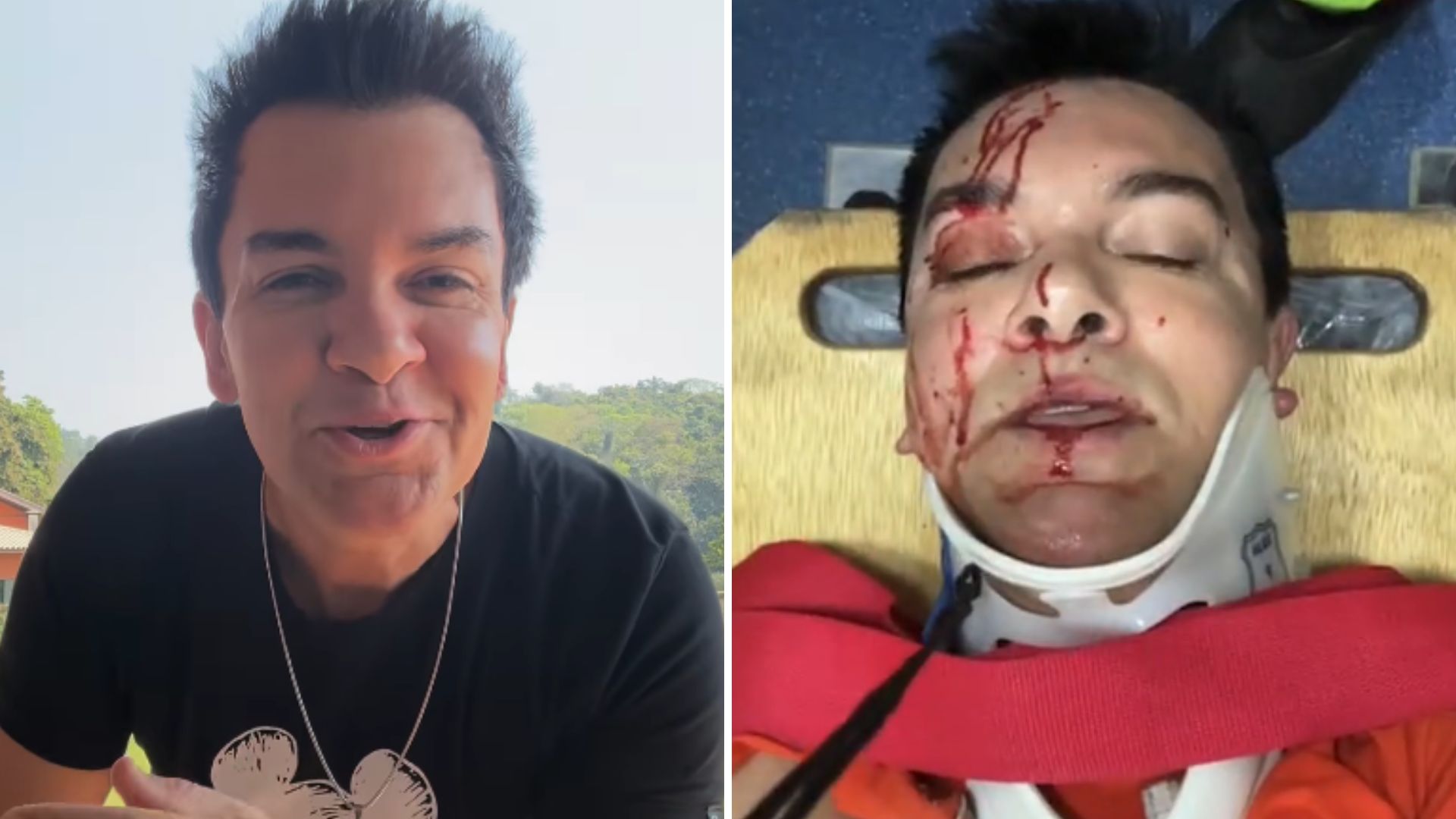 Regis Danese fica ensanguentado após sofrer grave acidente: “Muita dor”