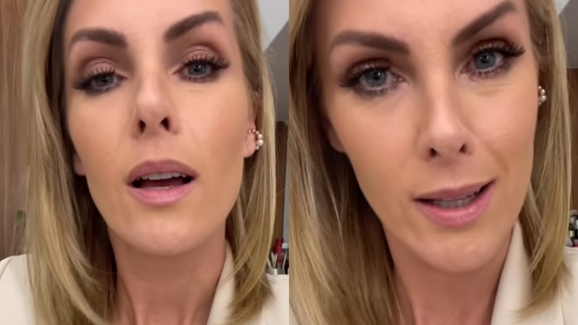 Ana Hickmann denuncia golpe que sofreu durante divórcio: “Tomem cuidado”
