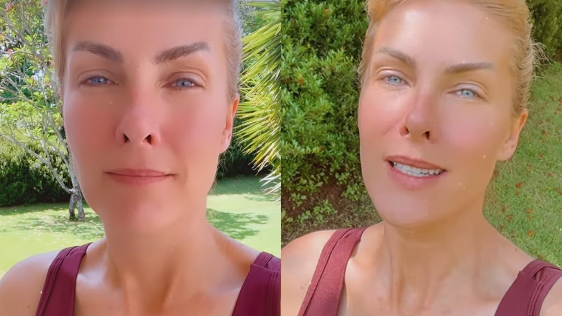 Ana Hickmann revela que agressão foi só o “ponto final”: “Demorei muito”