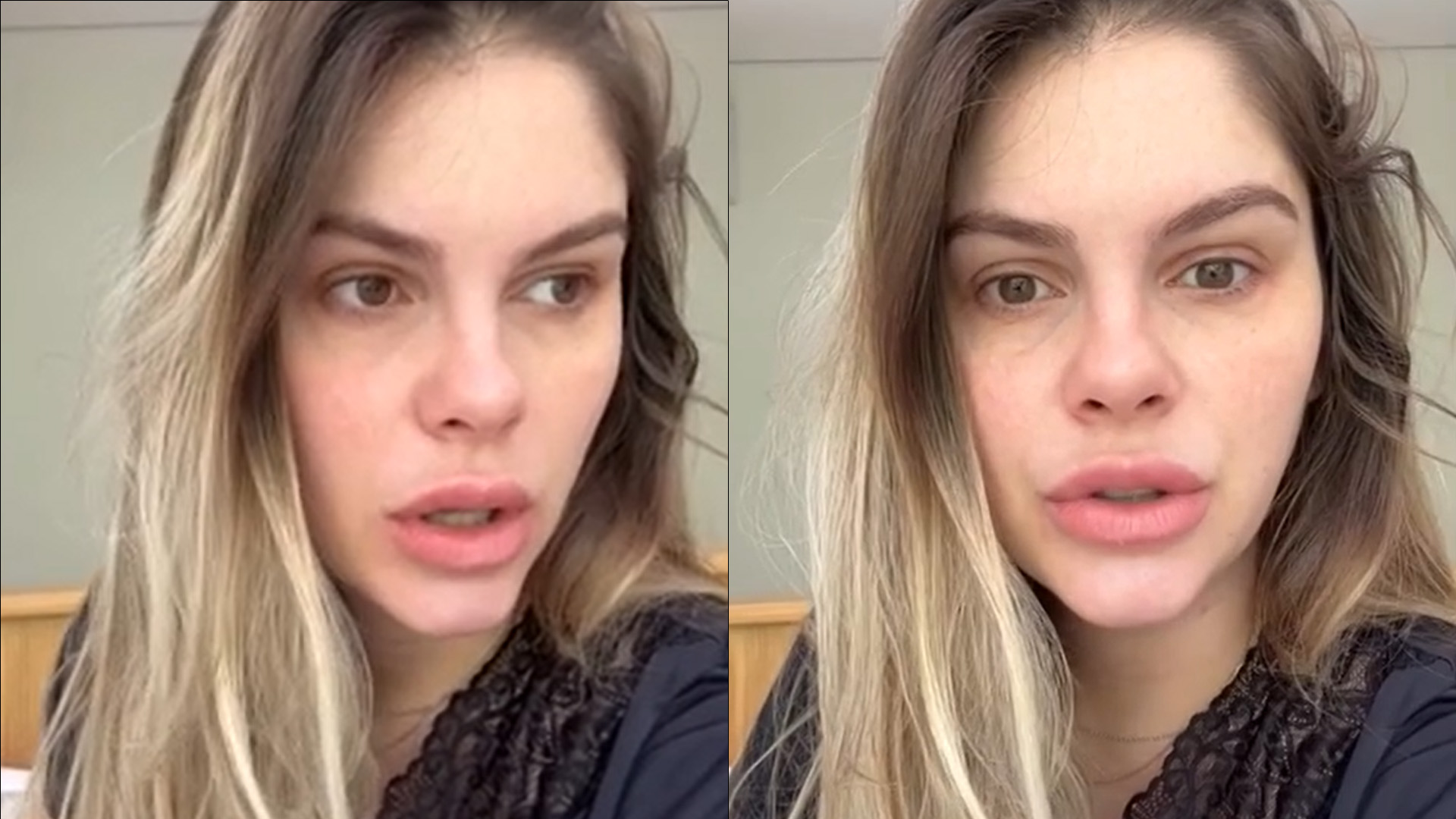 Bárbara Evans tem complicações com cesariana e assusta seguidores: “Abriu”