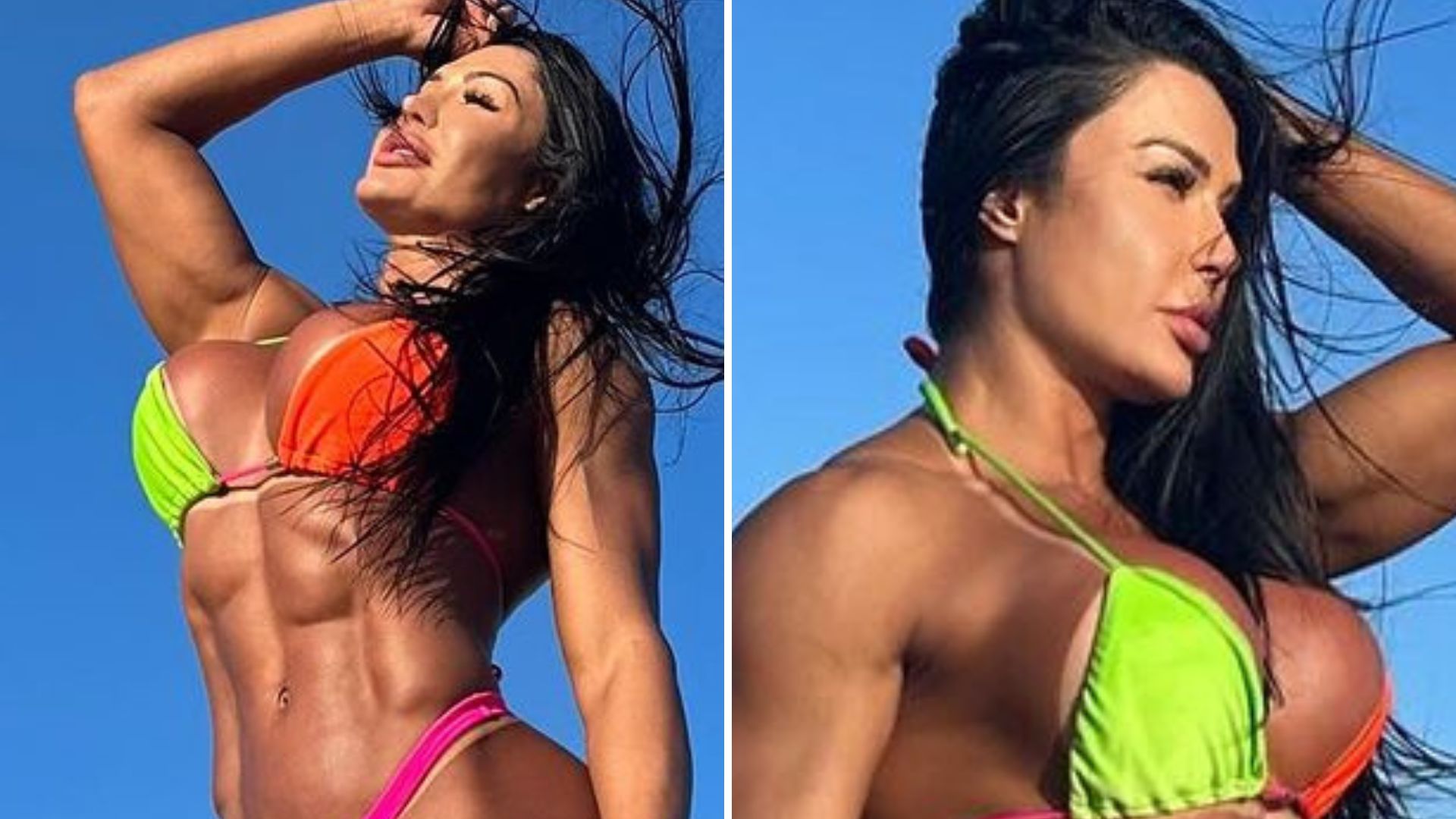 De biquíni, Gracyanne Barbosa deixa marquinha na virilha vazar: “Absurda”
