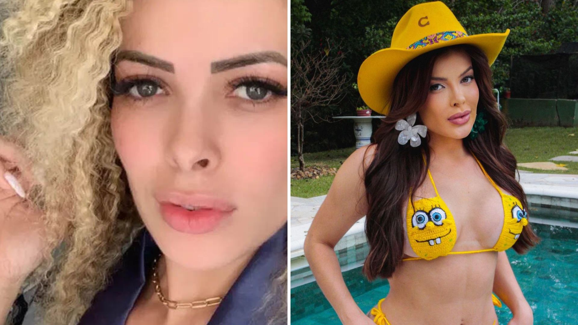 Harmonização, cirurgia e cabelo novo: O antes e depois de Jaquelline Grohalski