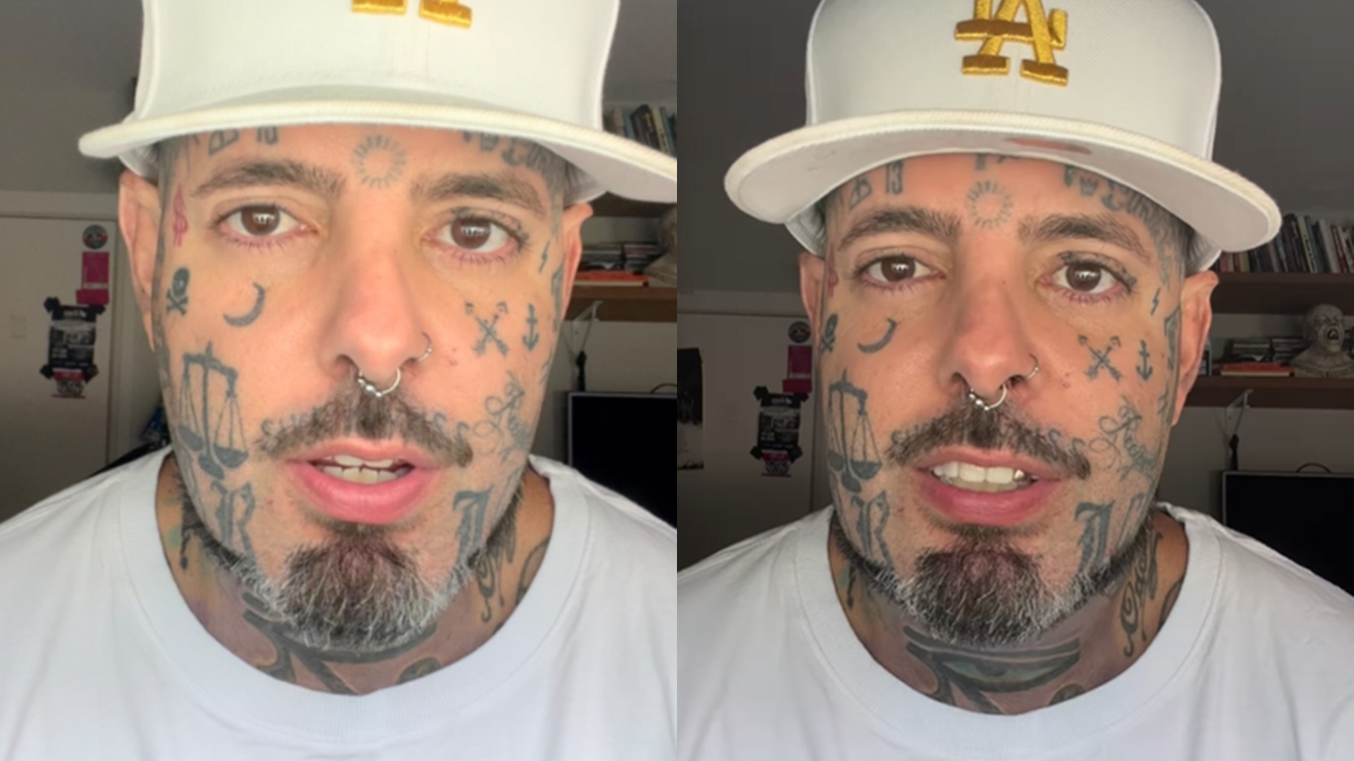 Tico Santa Cruz expõe evolução em tratamento com canabidiol: “Não tem milagre”