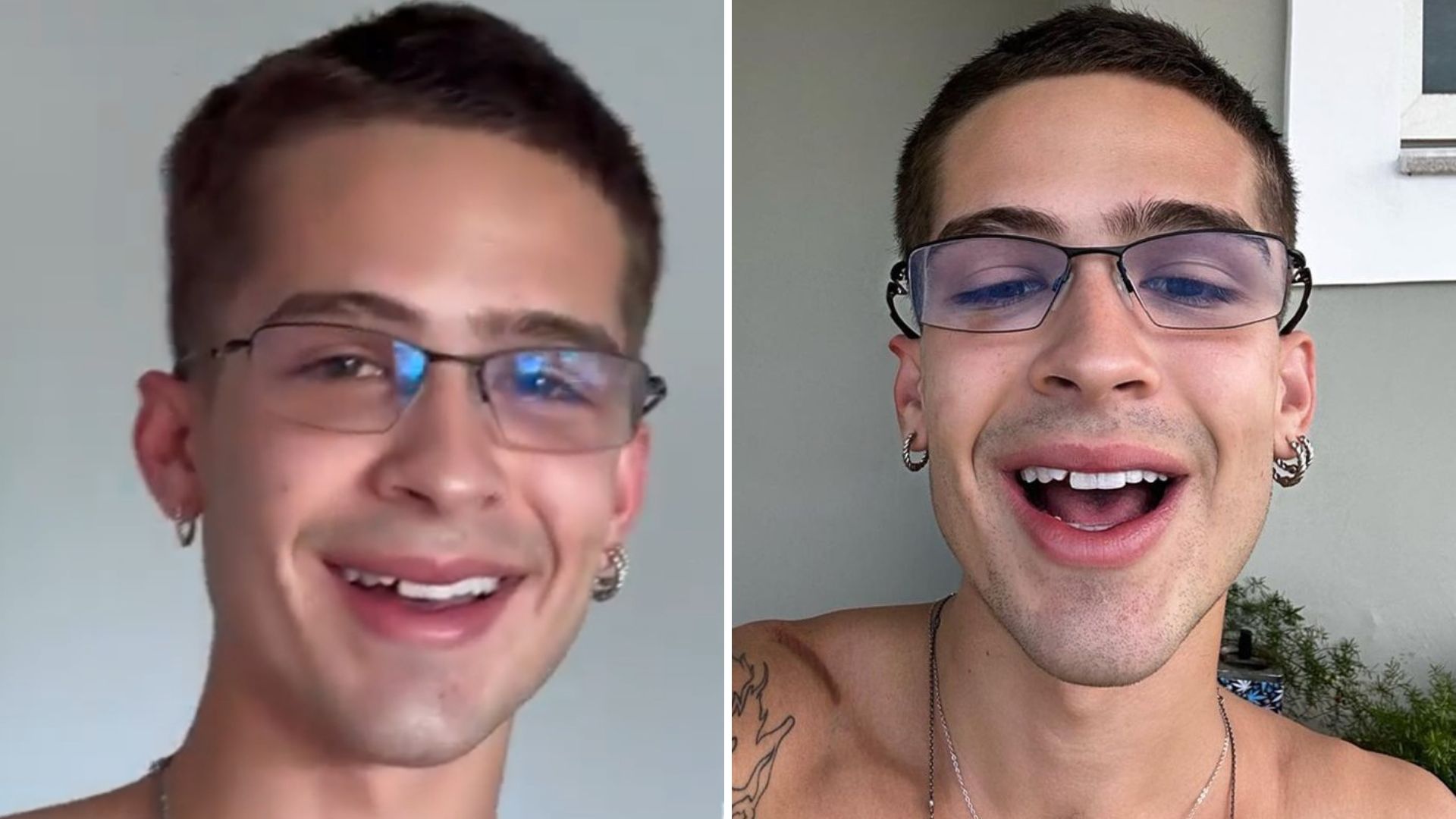 João Guilherme sofre pequeno acidente em Carnaval e perde parte do dente: “Bom?”