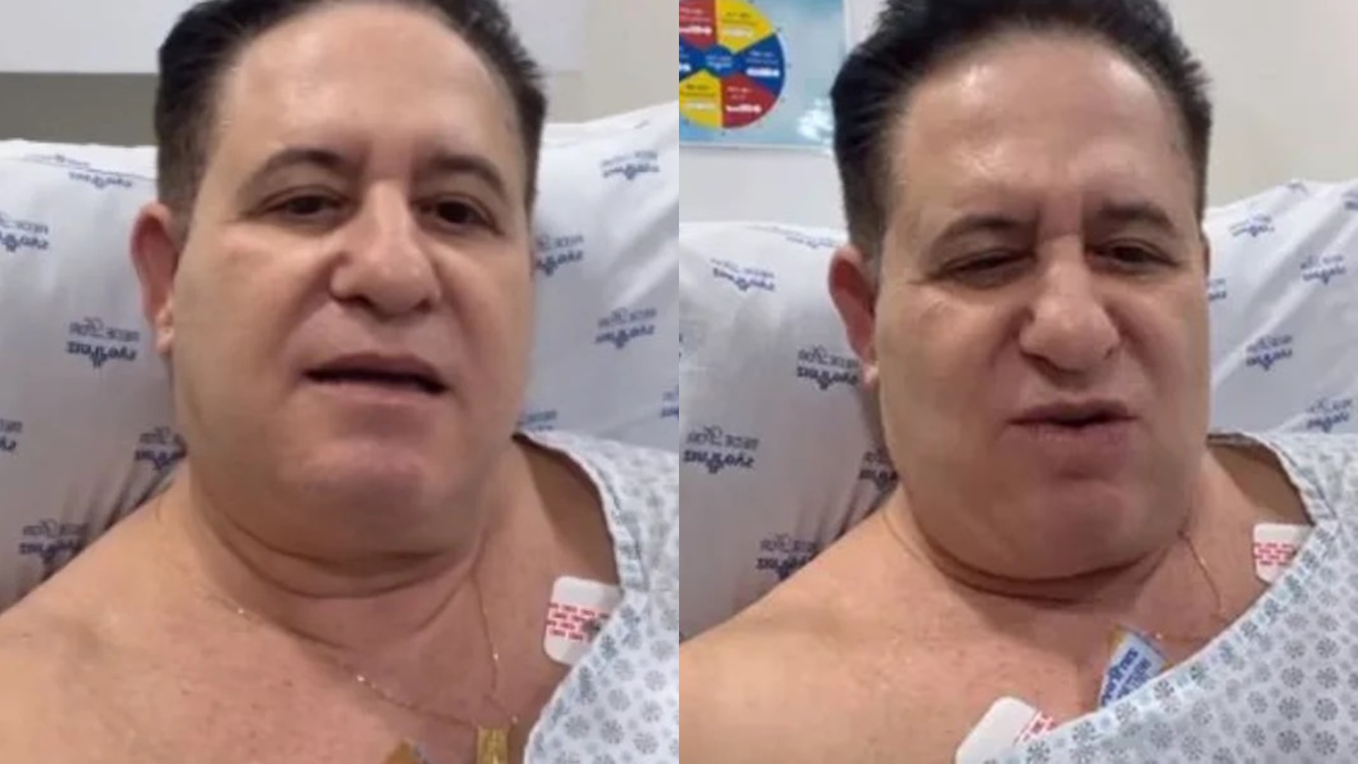Sertanejo Marrone tem ataque de pânico após passar por cirurgia de 7h no rosto