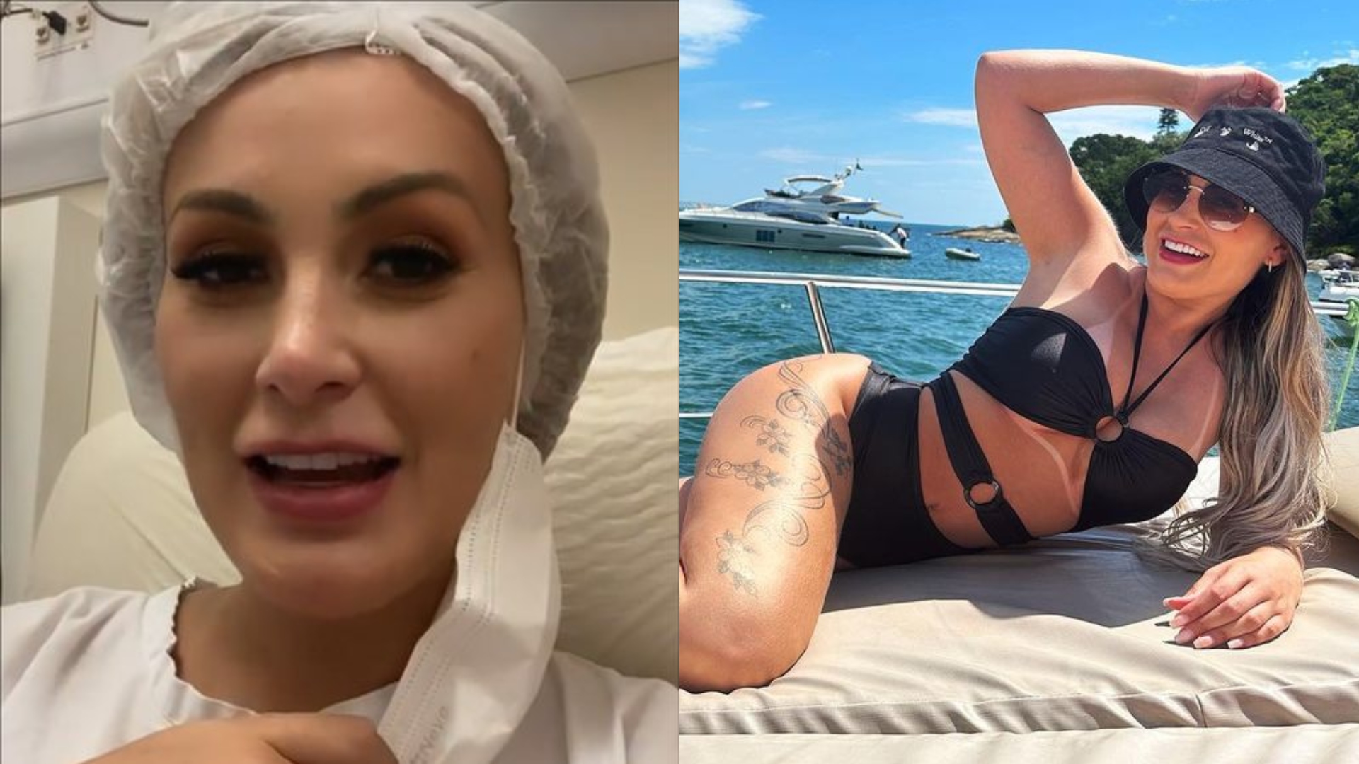 Após trauma de Andressa Urach, especialista aponta cuidados com o novo procedimento estético