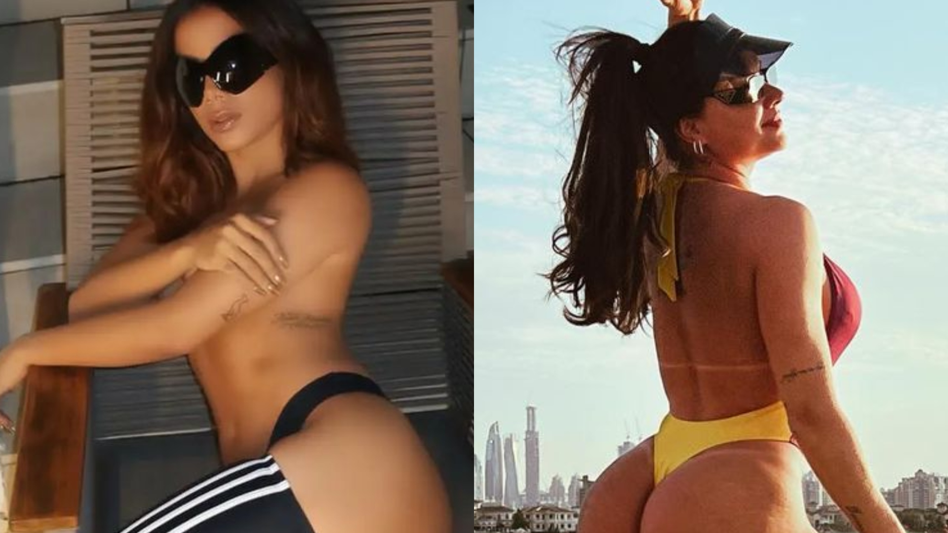 Anitta e Juju Salimeni apostam em procedimento para aumentar o glúteo; saiba como é feito