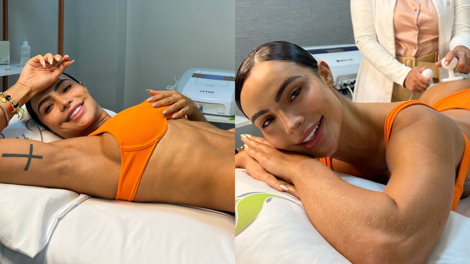 Aline Mineiro se prepara para o Carnaval e faz tratamento estético no bumbum e na cintura; veja