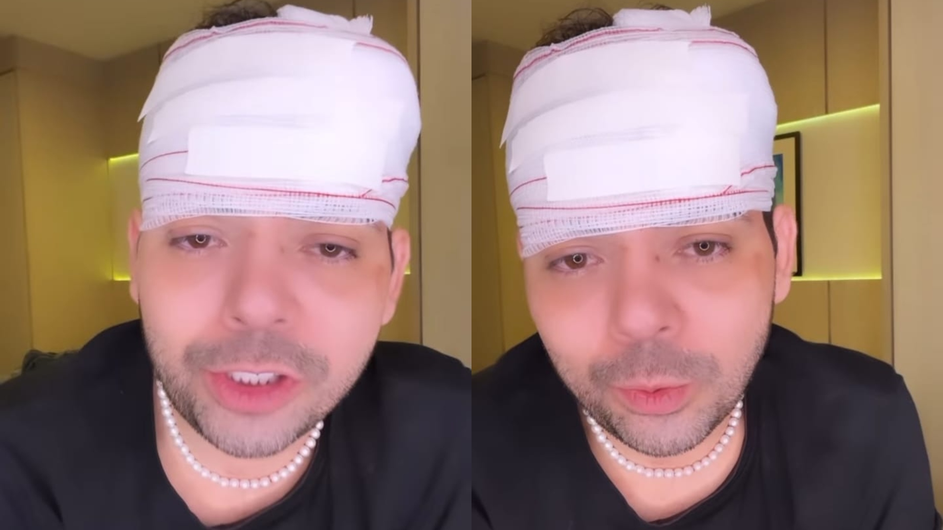 Humorista Gustavo Mendes sofre agressão brutal em tentativa de assalto: “Cheio de sangue”