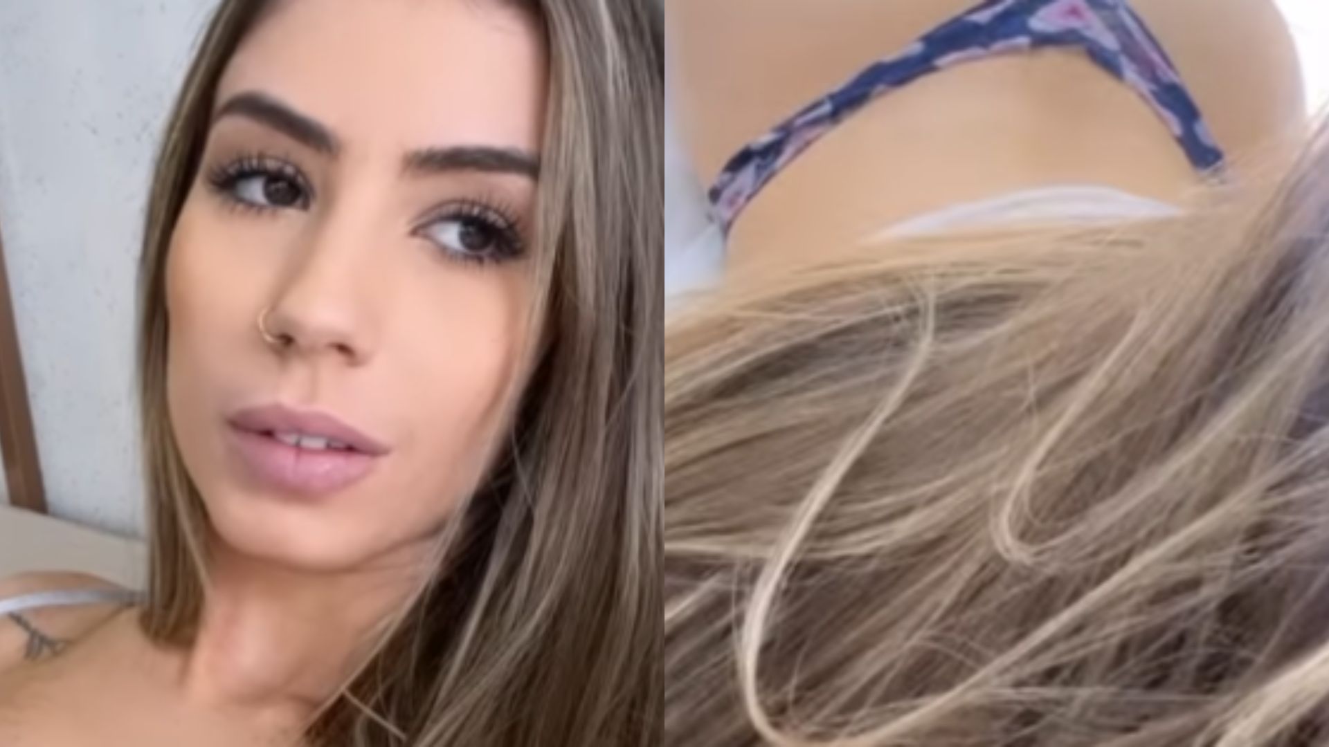 Ex de Whindersson Nunes faz procedimento para definir curvas e dispara: “Picadinhas de amor”
