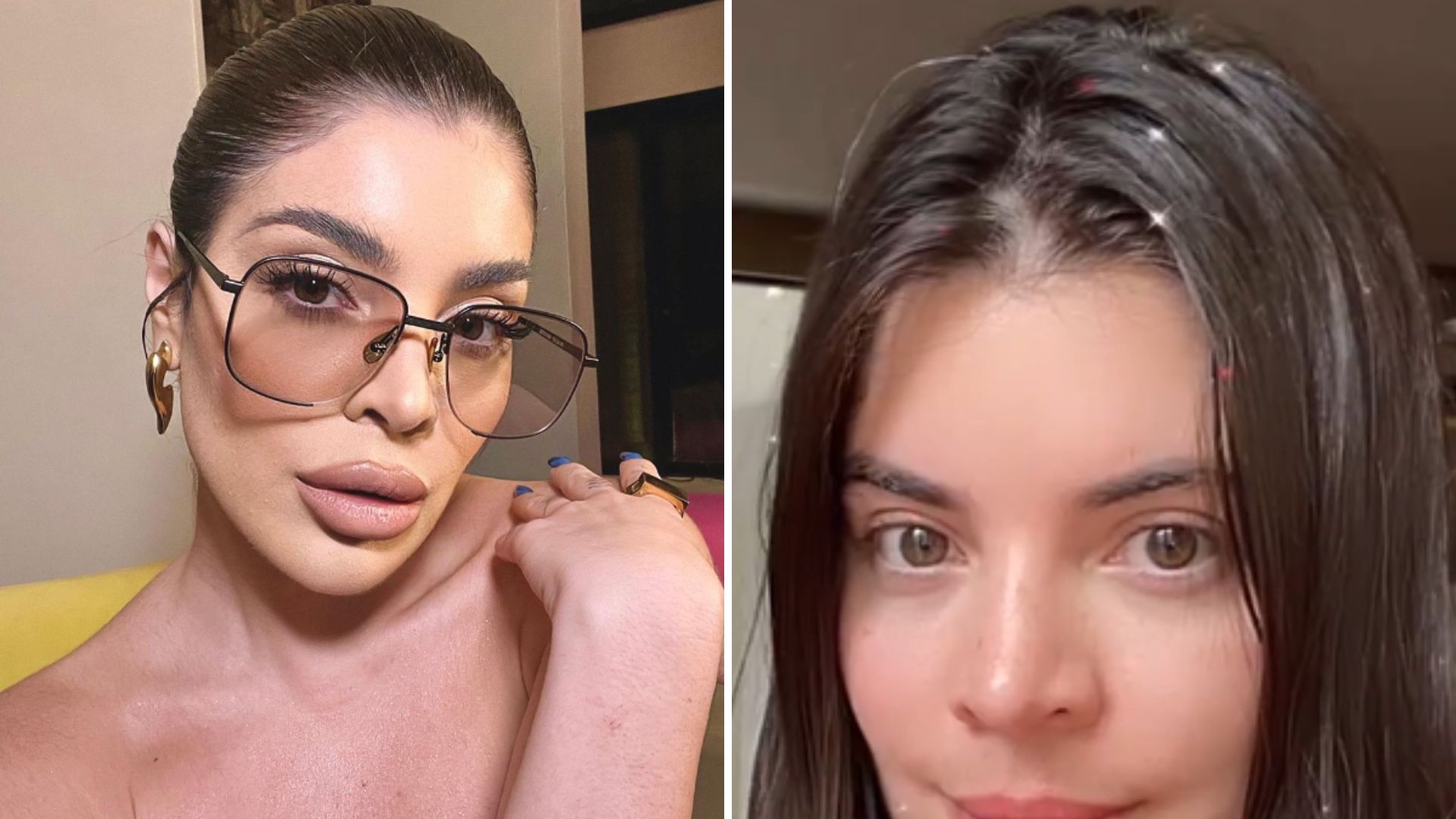 Gkay remove preenchimento labial e surge completamente diferente: “Me acostumando”