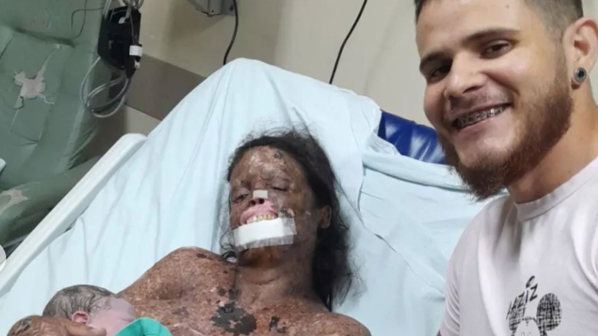 Influenciadora com doença rara anuncia o nascimento de sua filha: “Esbanjando saúde”