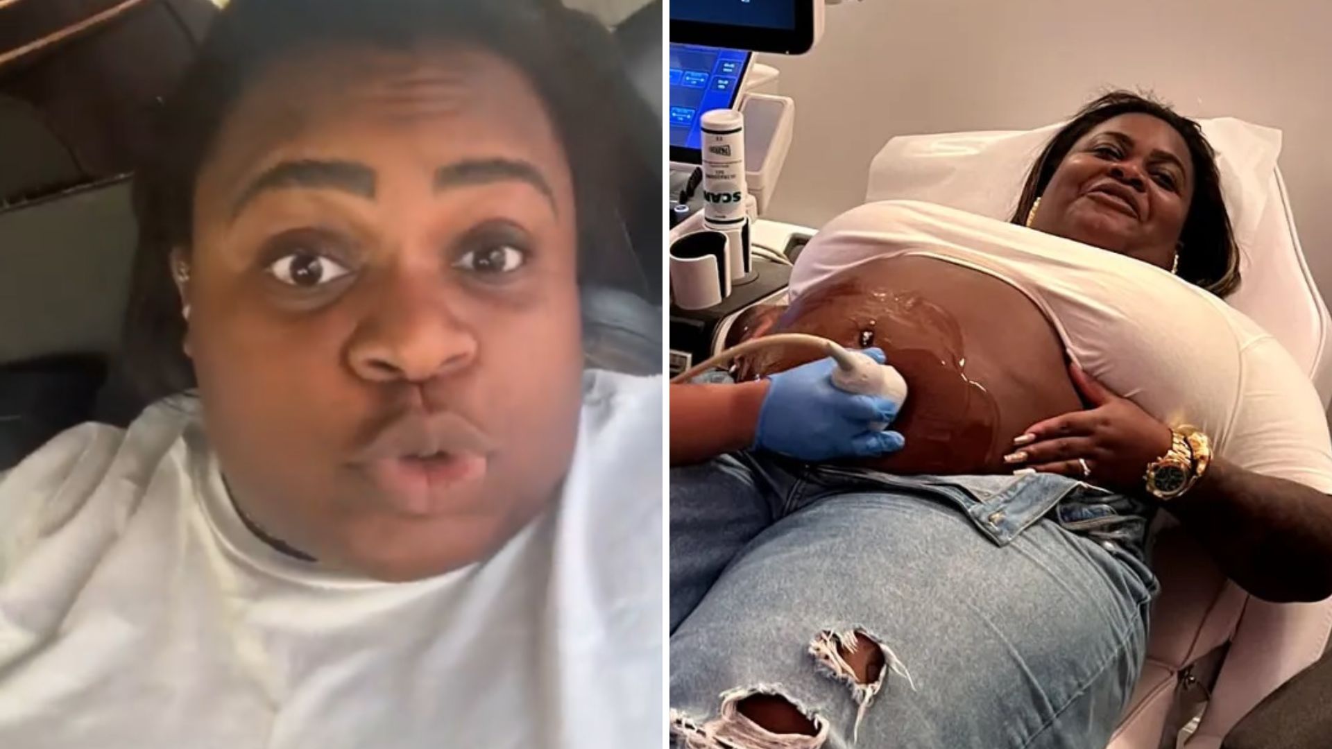 Jojo Todynho estoura após comentários sobre a cor de seu filho: “Não vem com hipocrisia”
