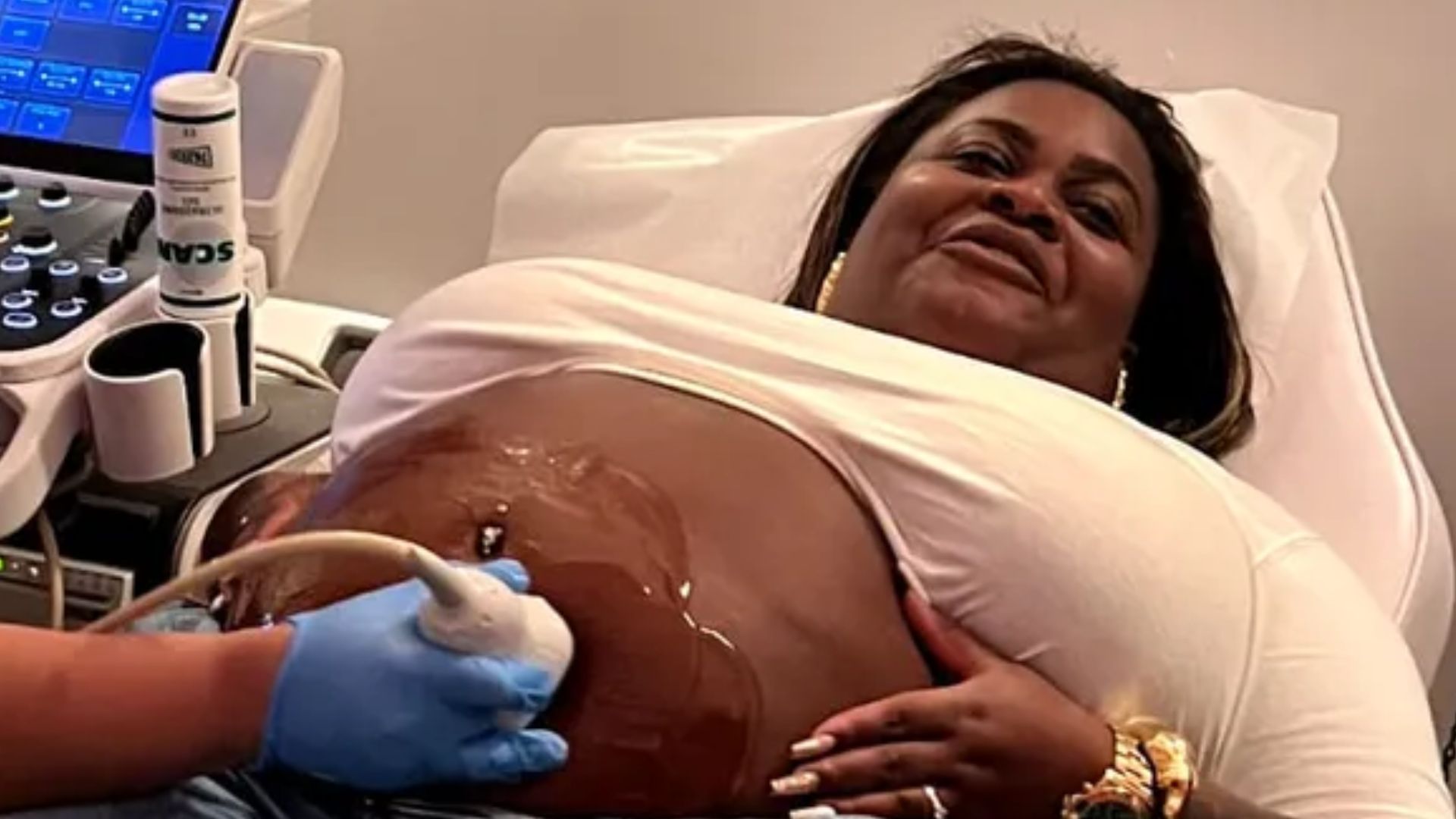 Após previsão de vidente, Jojo Todynho faz primeiro ultrassom e revela nome da filha