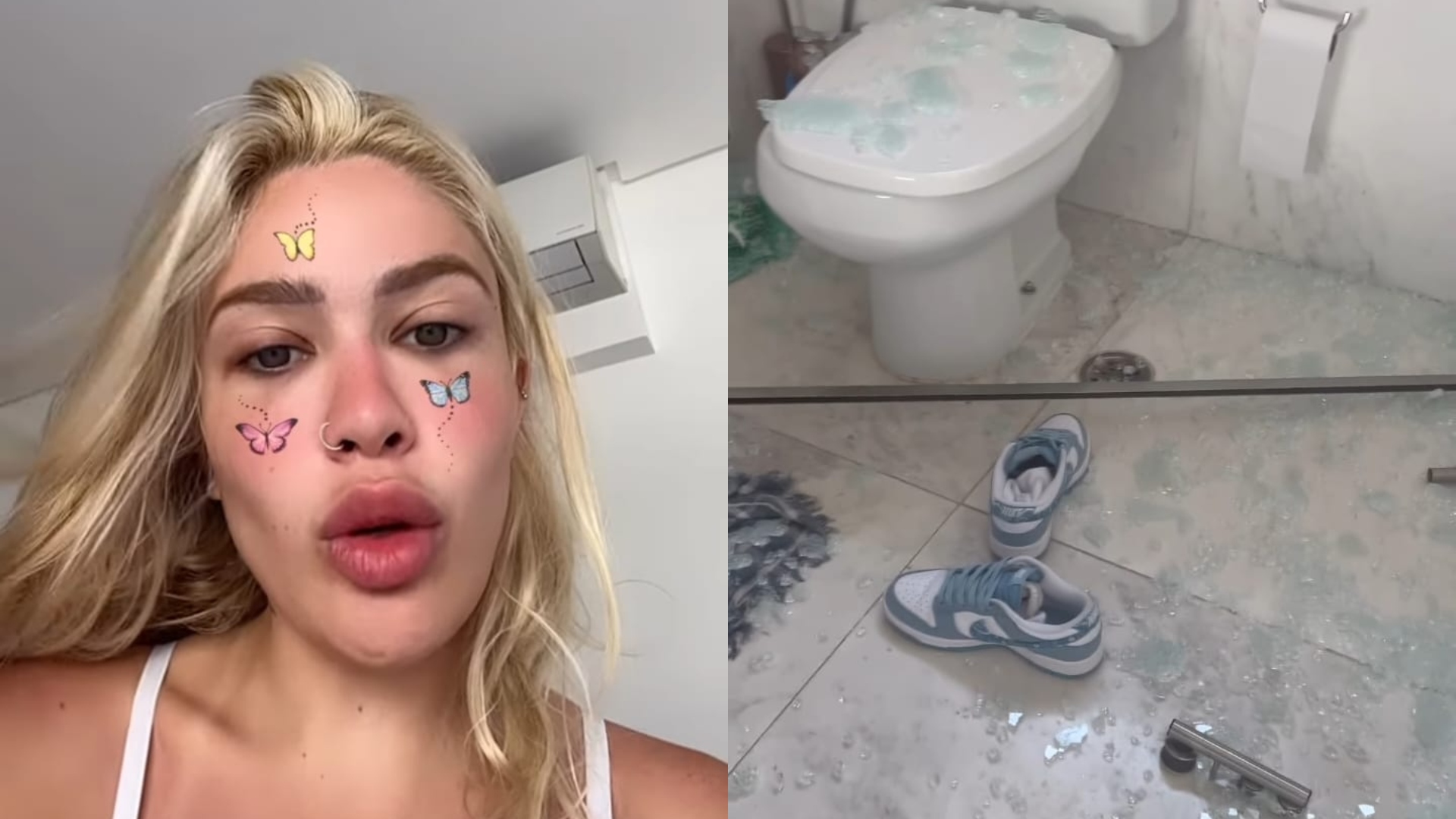 Karoline Lima sofre acidente doméstico e mostra machucados após sufoco: “Que nervoso”