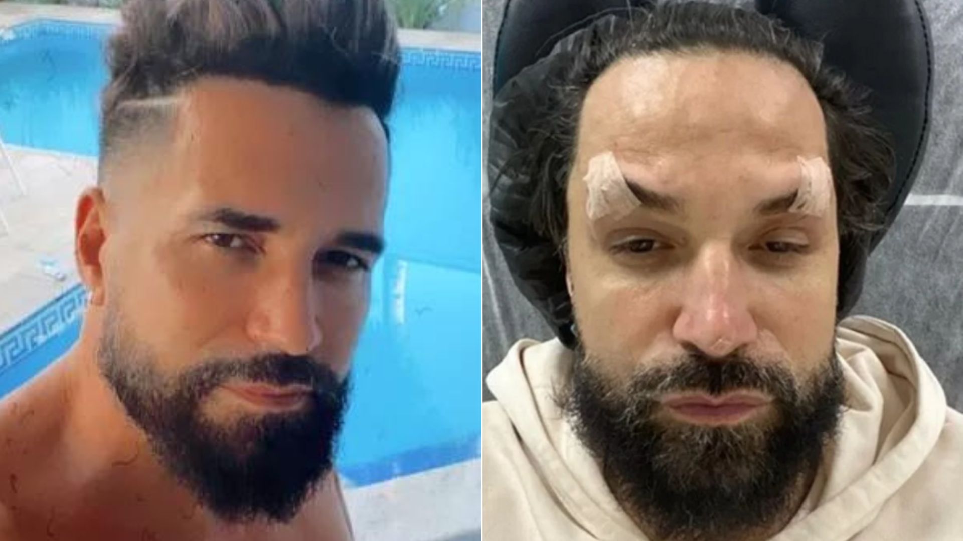 Após ataques por aparência facial, Latino faz forte desabafo: “Fica difícil”