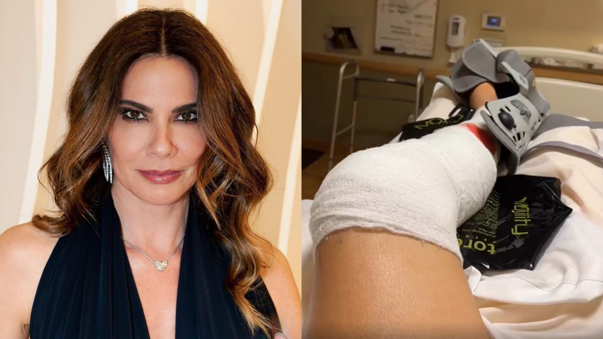 Luciana Gimenez inicia tratamento após grave acidente na neve: “Alta está prevista”
