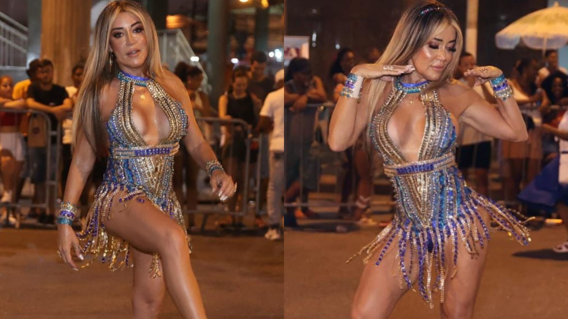 Após cirurgia, Mulher Abacaxi surge com o rosto inchado no ensaio para o Carnaval: “Nem me reconhecendo”