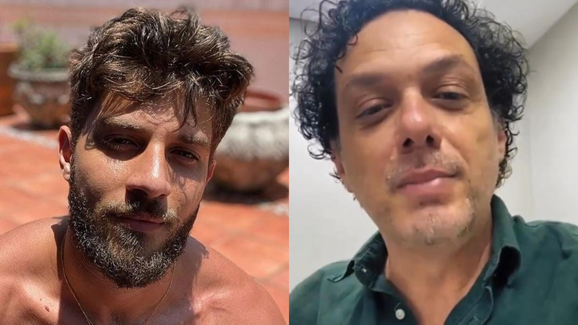 Pai de Chay Suede faz harmonização para rejuvenescer e antes e depois impressiona