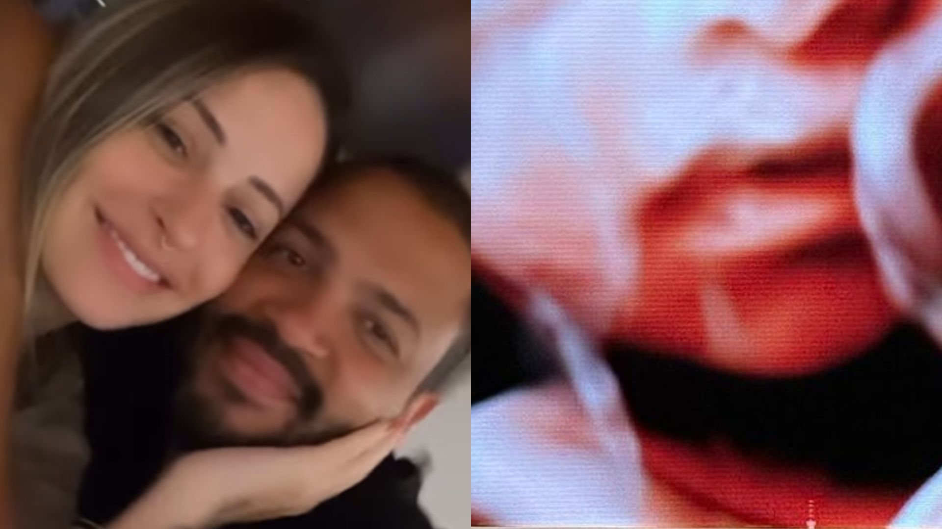 Ex-BBB Projota encanta fãs ao mostrar rostinho do bebê no ultrassom: “Clonaram”