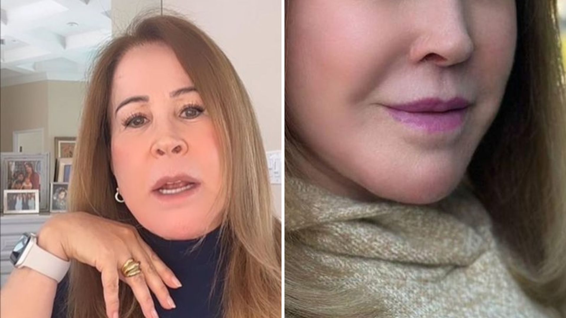 Zilu Camargo surge mais jovem após carregar no filtro e web desaprova: “É você?”