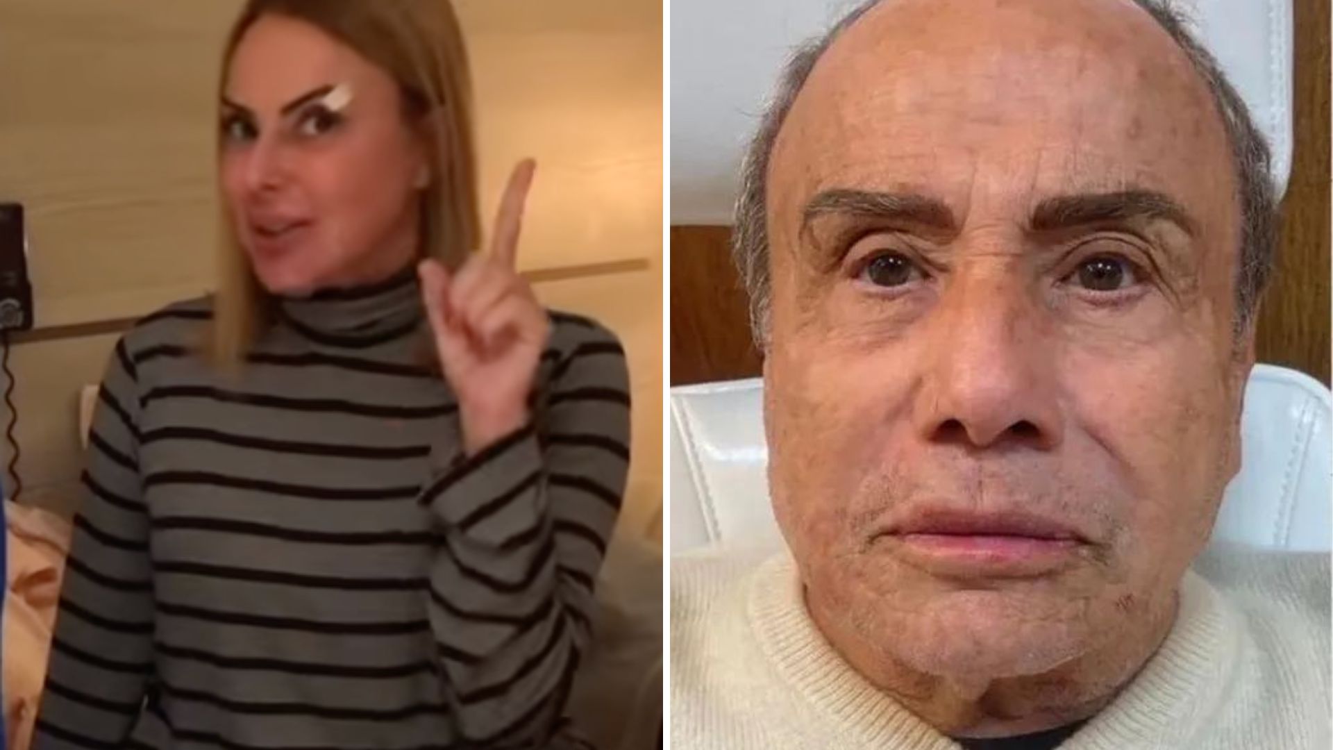 Esposa de Stênio Garcia nega que infecção foi causada pela harmonização: “Descartada”