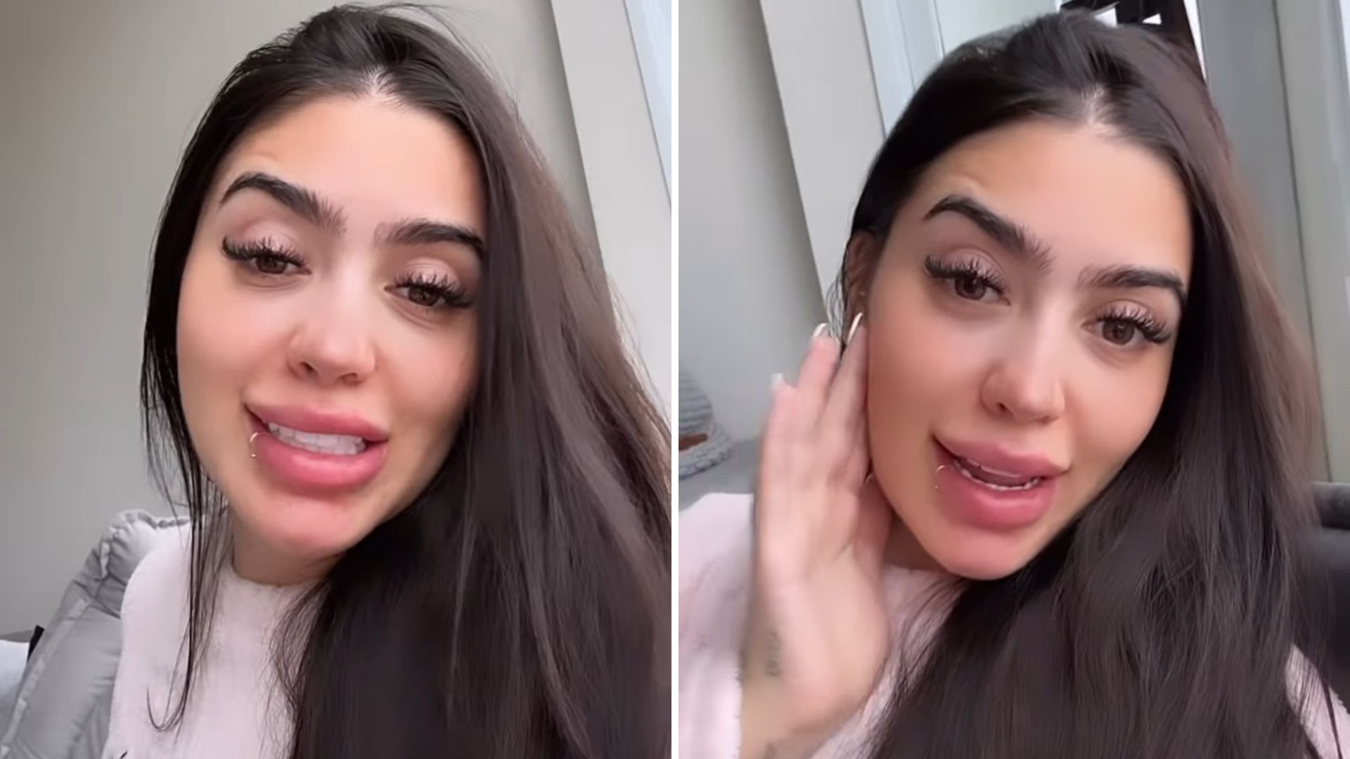 Grávida, MC Mirella explica mancha roxa no corpo: “Remoção”