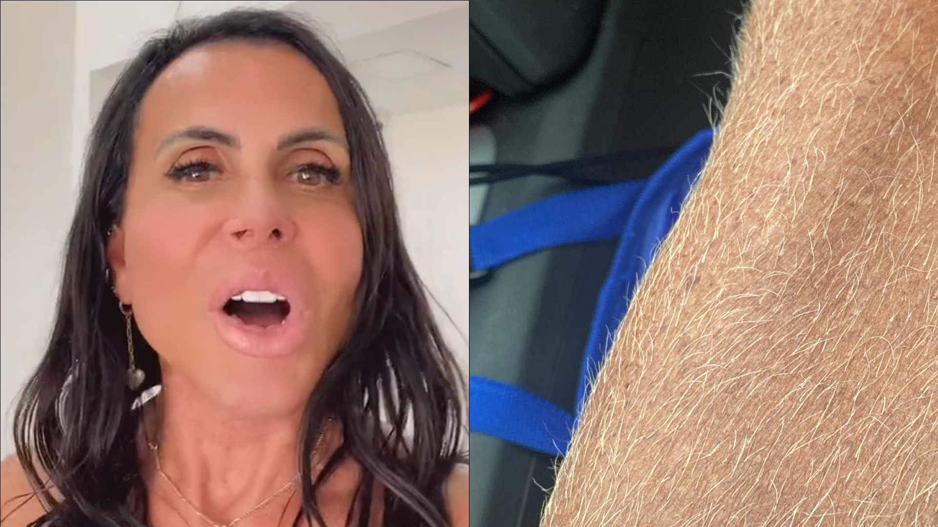 Gretchen dá zoom na perna peluda e visual diferentão causa alvoroço: “Apaixonada”