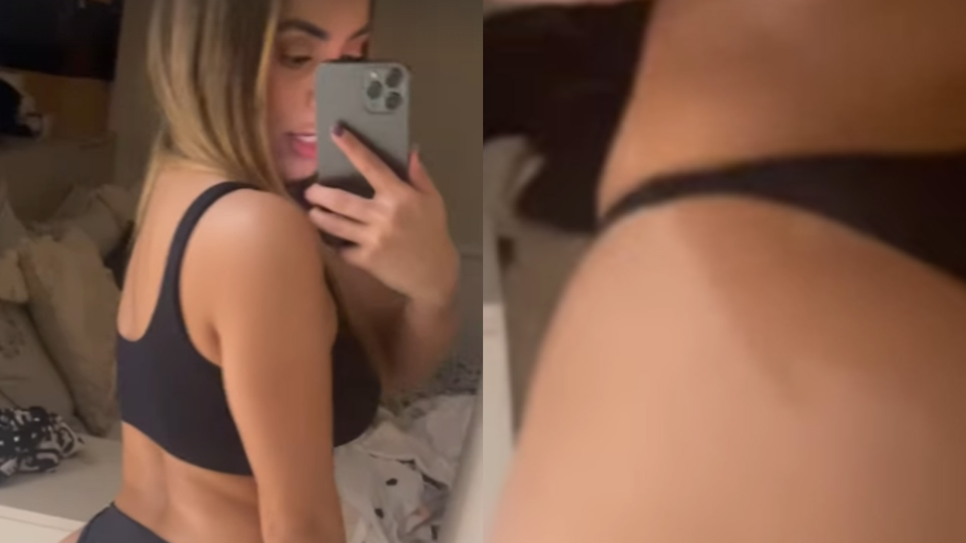 De calcinha mínima, Lexa revela resultado de procedimento no bumbum: “Sem filtro”