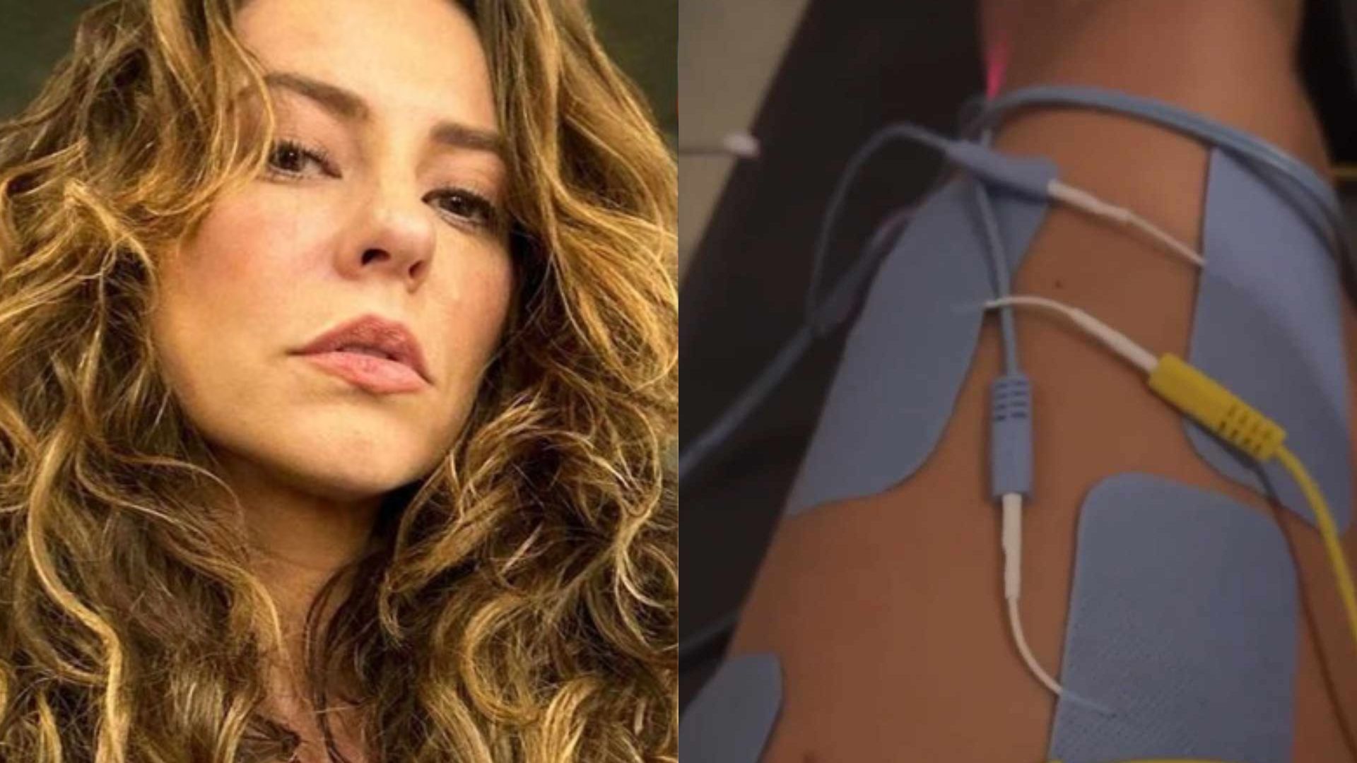 Paolla Oliveira desabafa sobre tratamento após sofrer grave lesão: “Minha saga”