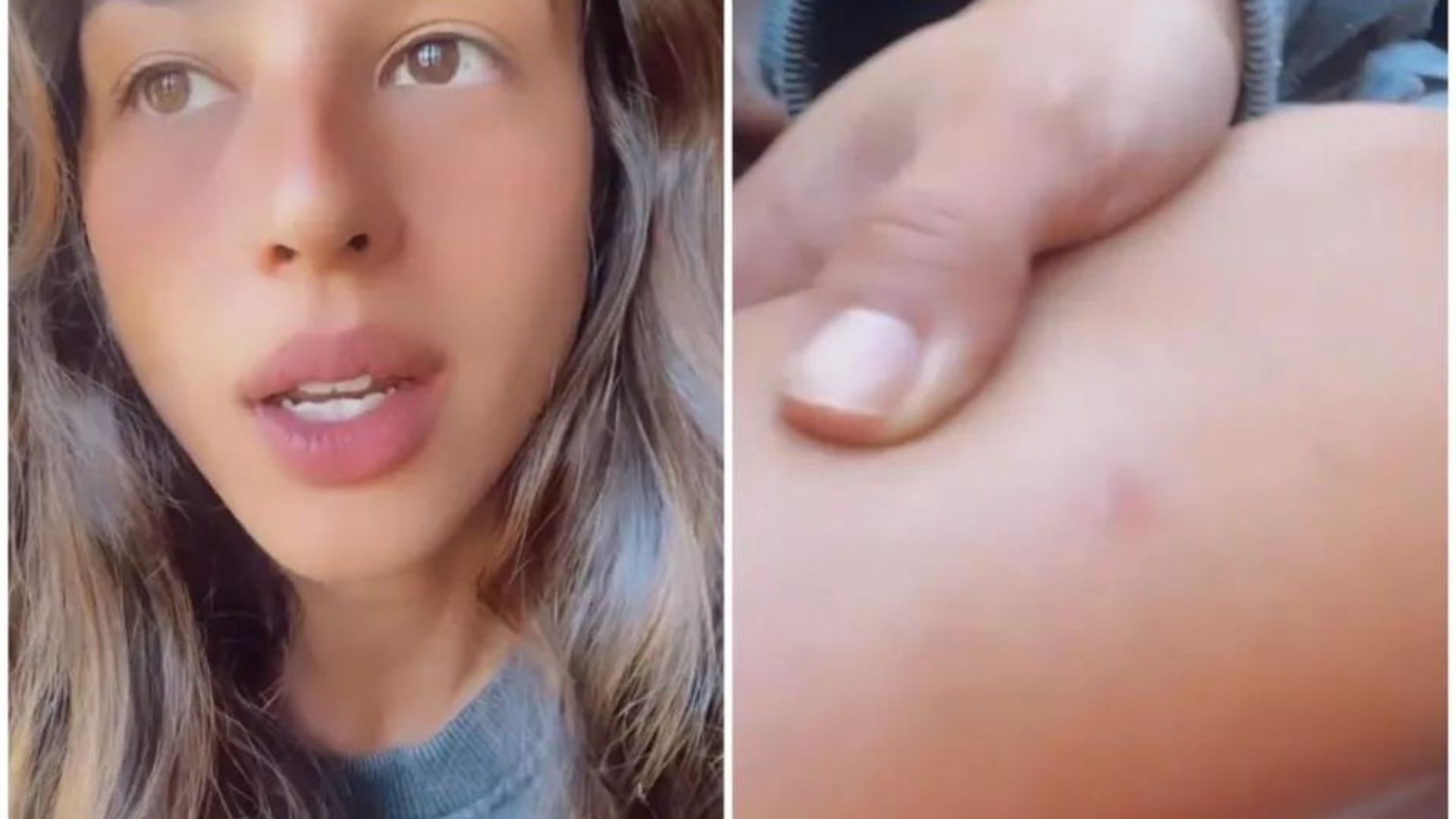 Yanna Lavigne é picada por carrapato e surge abatida: “Nunca fiquei tão mal”