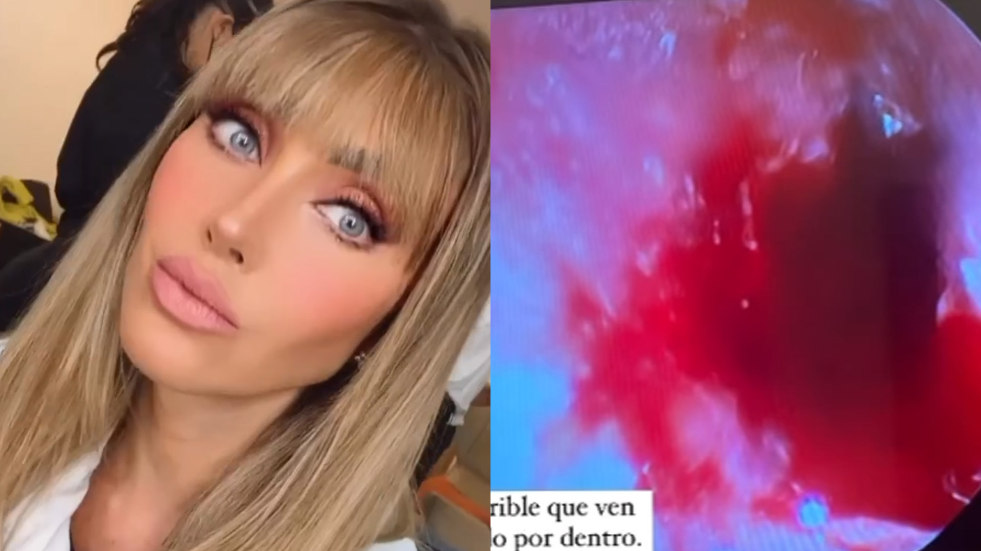 Anahí, do RBD, sofre acidente grave e pode ter sequelas: “Não ouço nada”