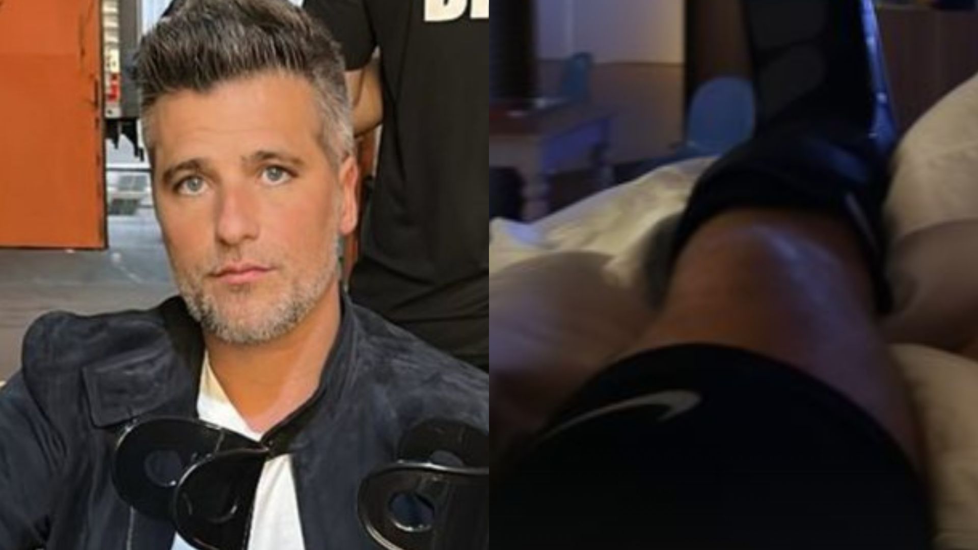 Como assim? Bruno Gagliasso surge de muletas e motivo surpreende: “Não me preparei”