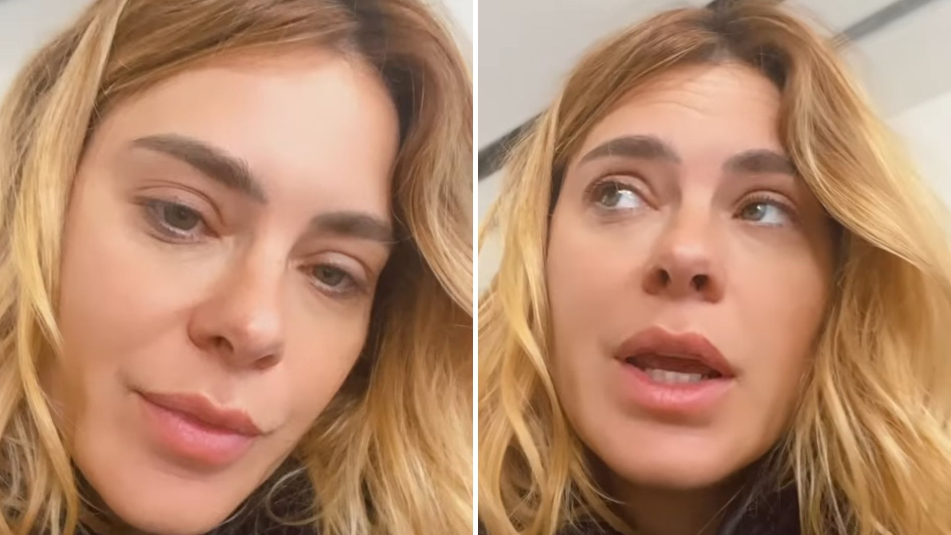 Carolina Dieckmann esclarece inchaço facial e nega harmonização: “Acham que enlouqueci”