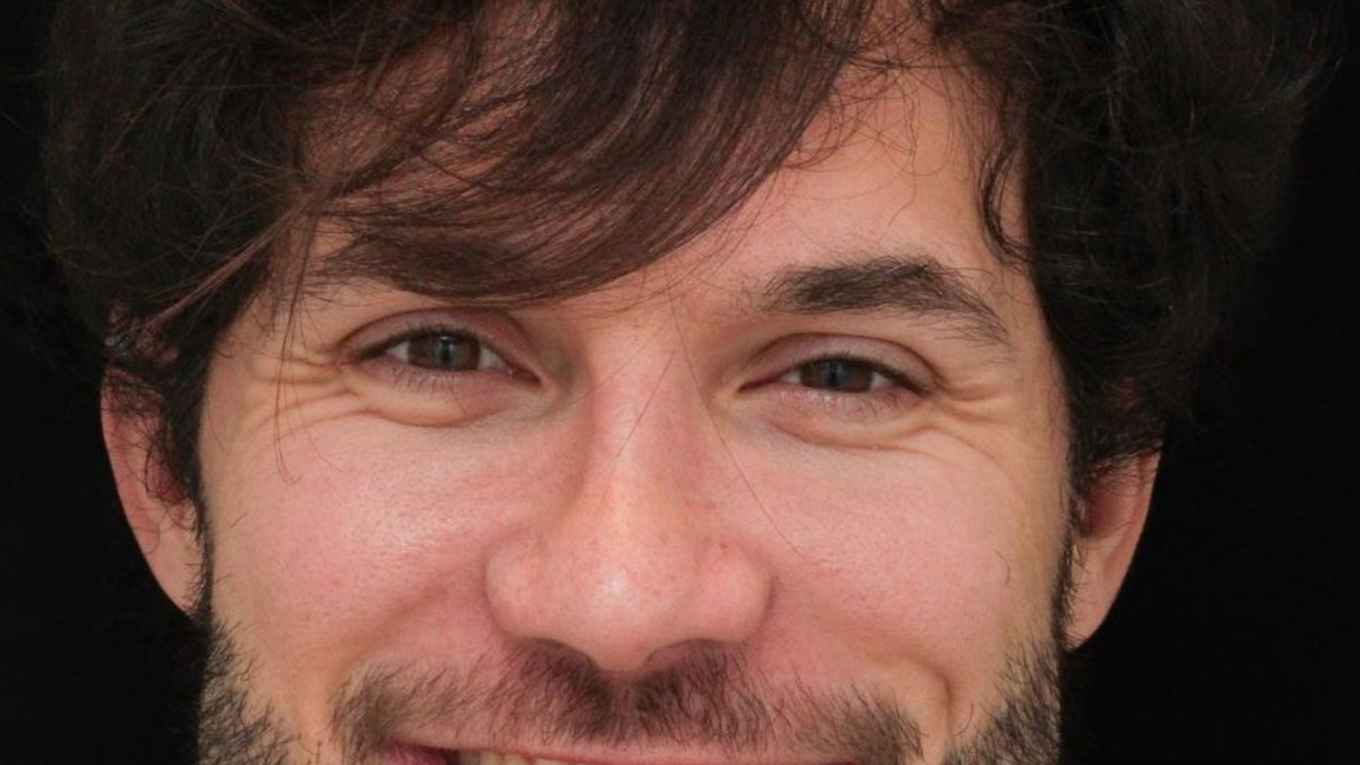 Ex-BBB Eliezer surpreende ao expor antes e depois dos dentes: “É outra pessoa”