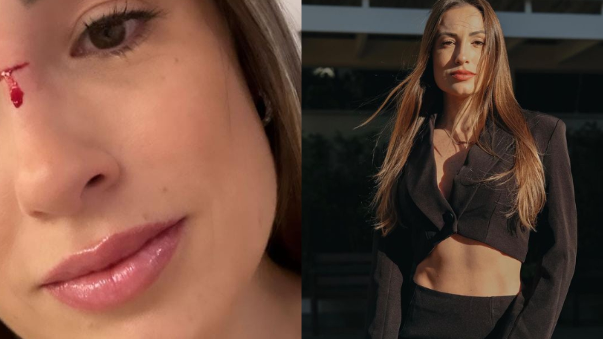 Após grande perda, ex-BBB Jéssica Mueller sofre acidente em carro: “Deu nisso”